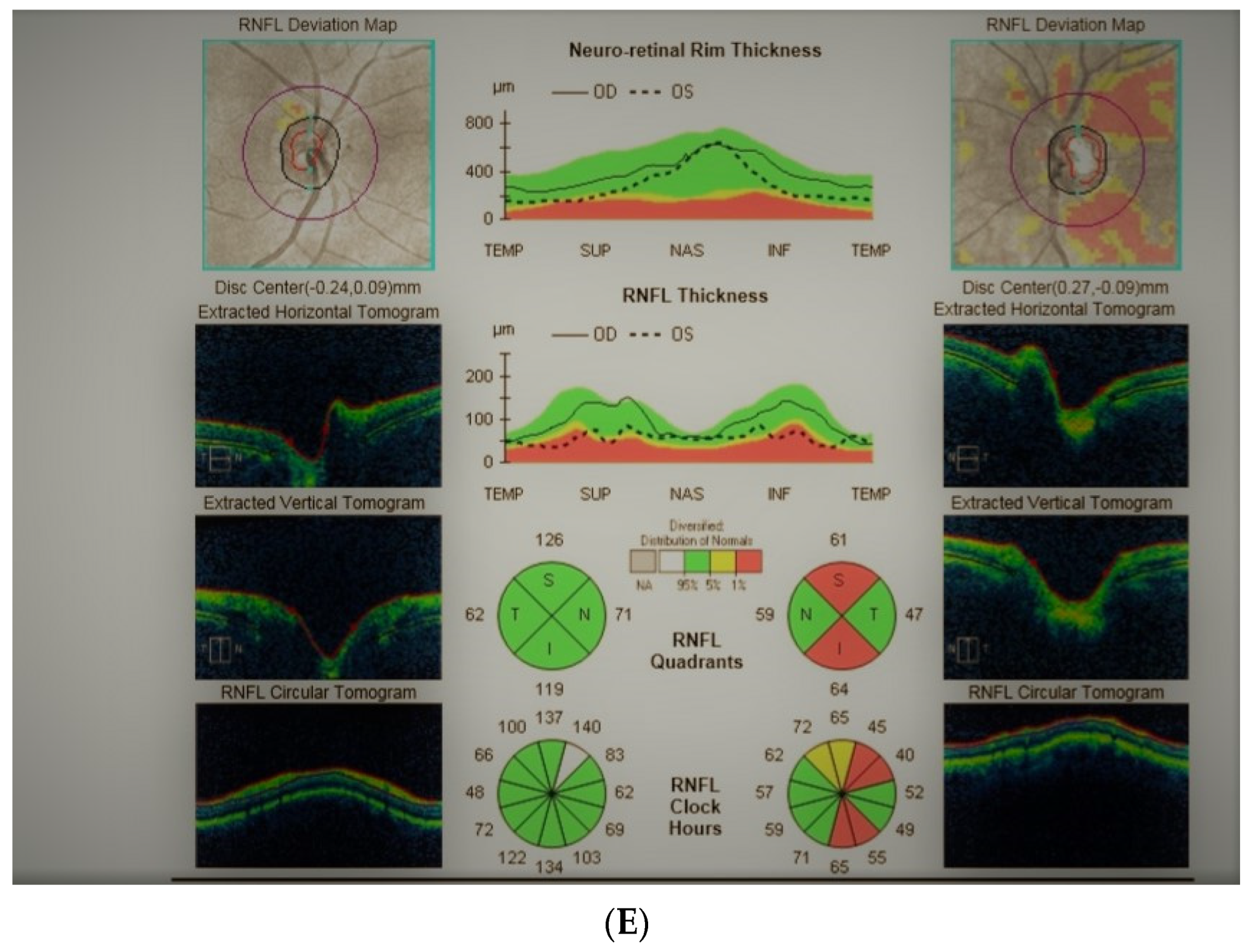 Diagnostics 11 02374 g004b