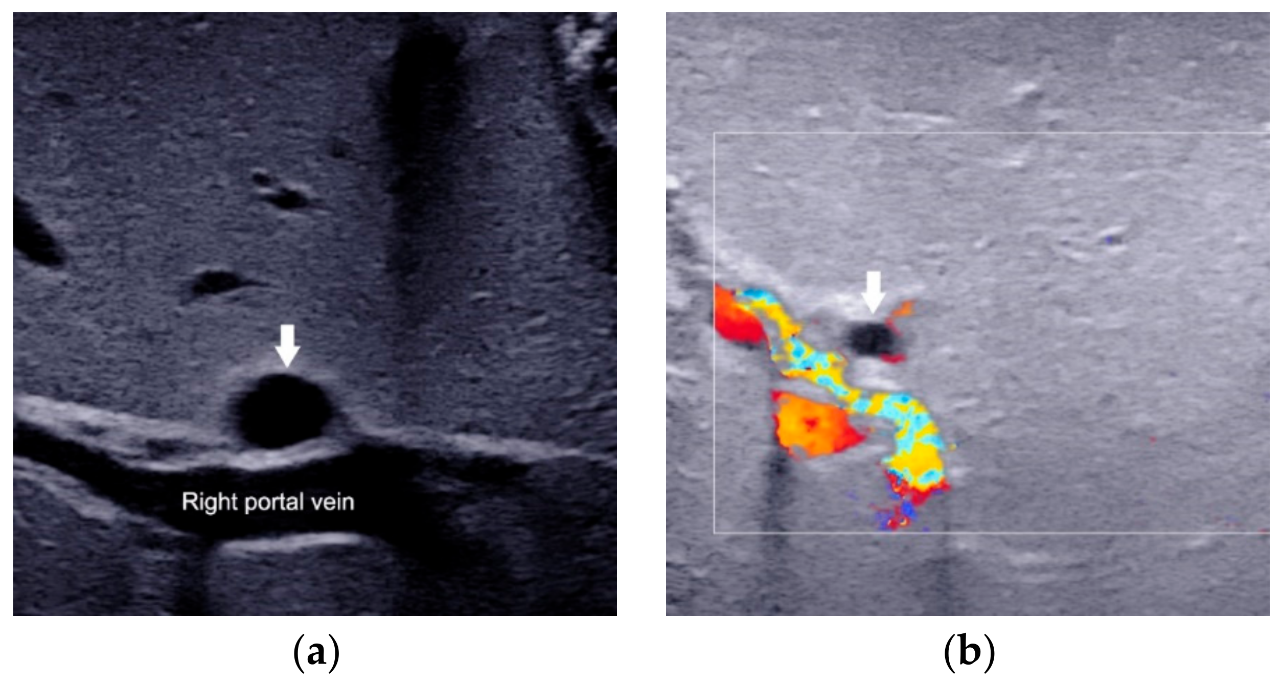 Diagnostics 12 00051 g003