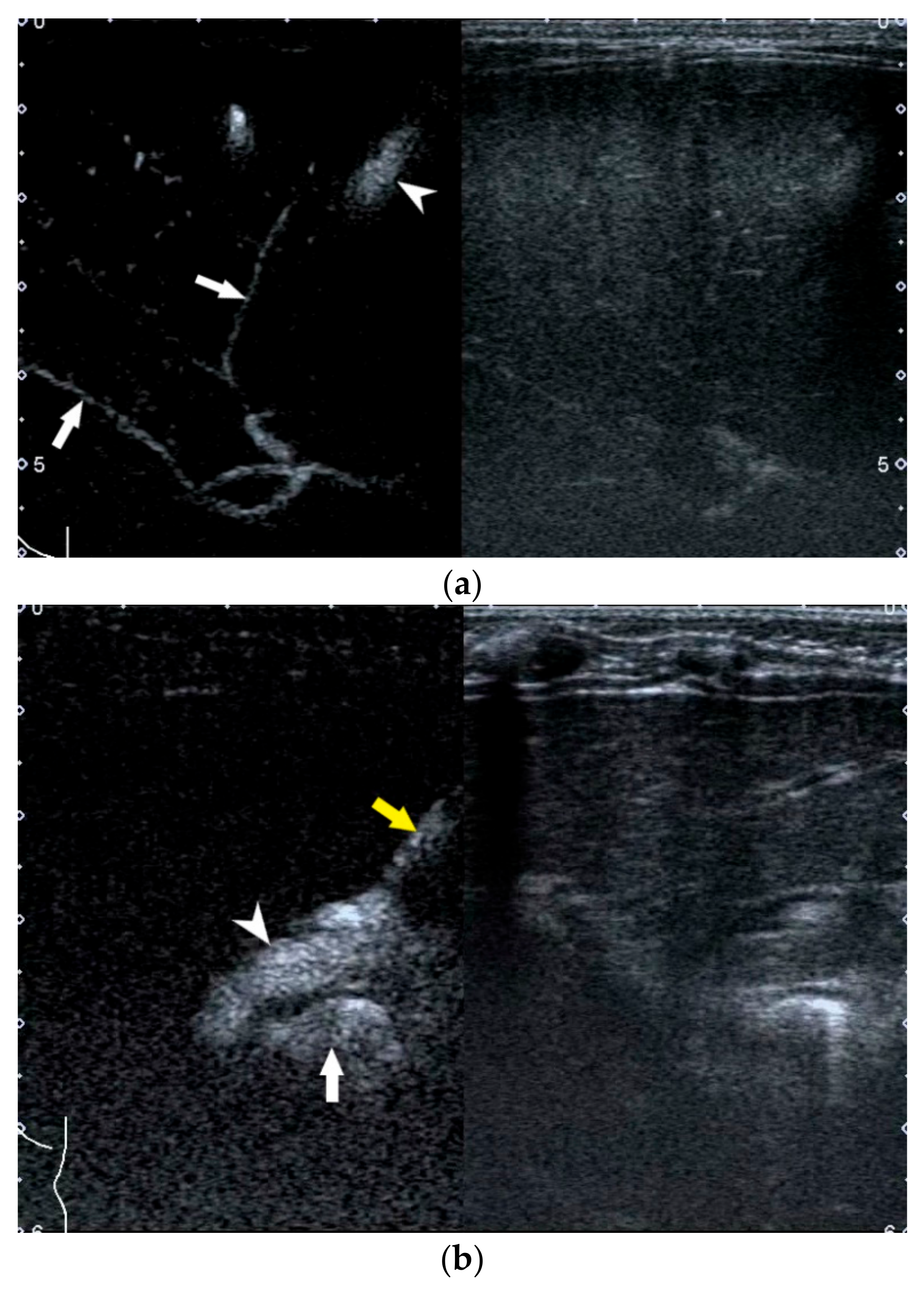 Diagnostics 12 00051 g008
