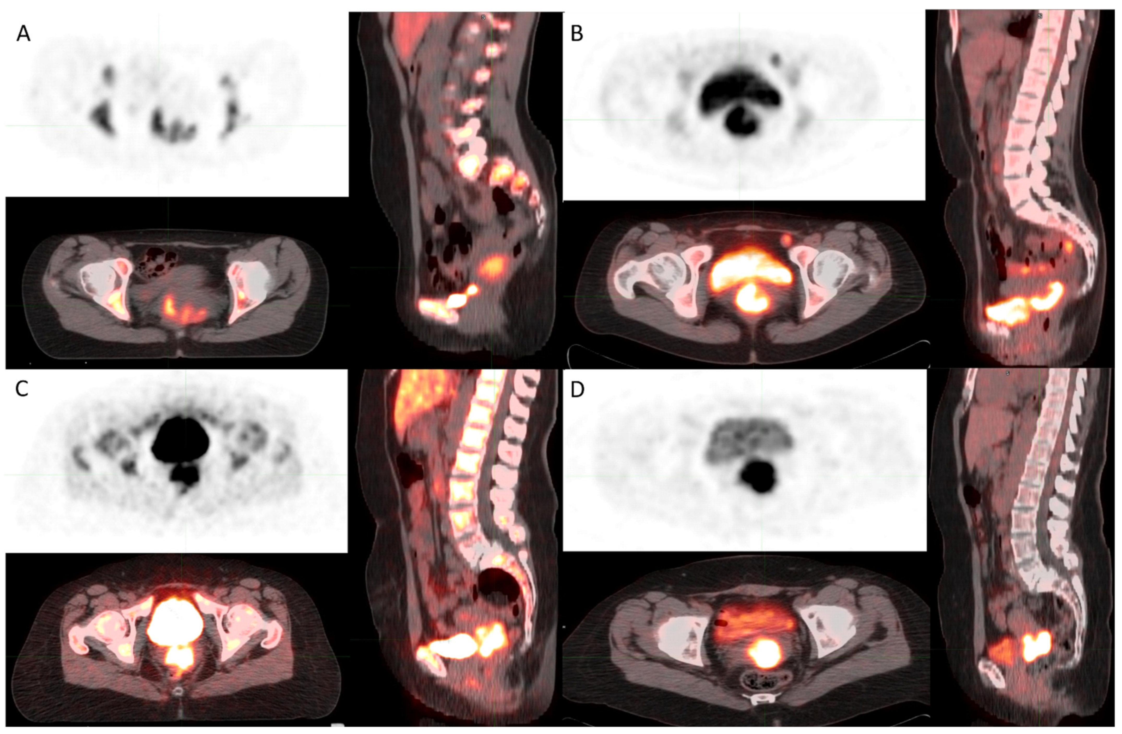 Diagnostics 12 00070 g005