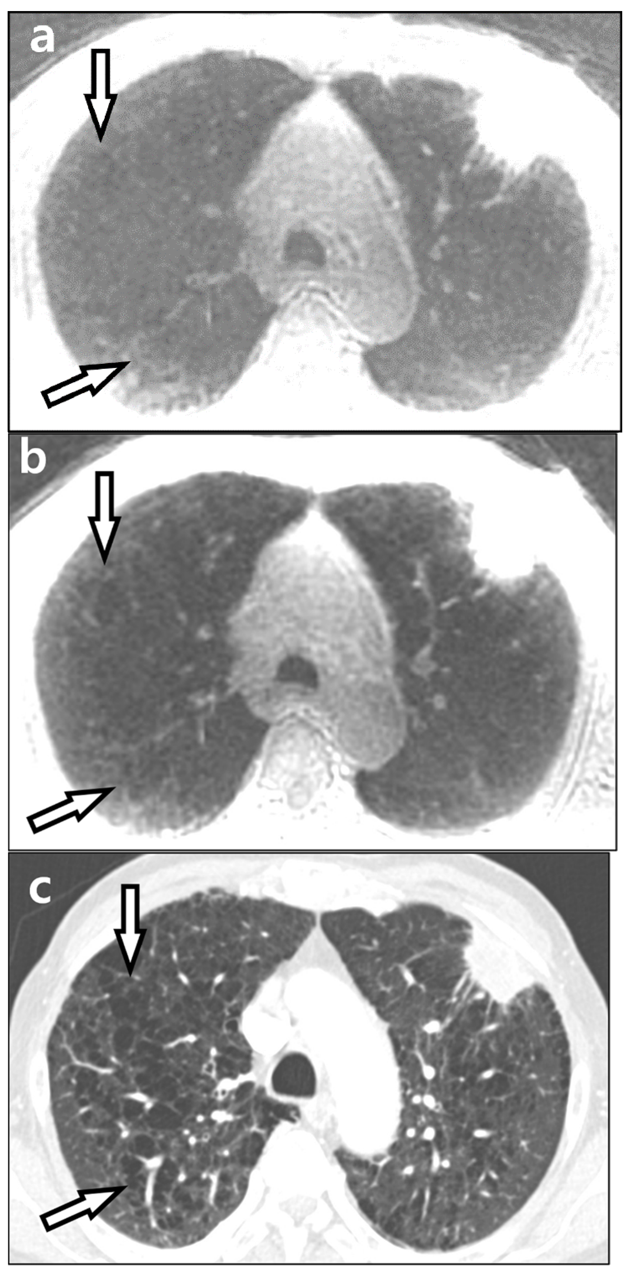 Diagnostics 12 00148 g003