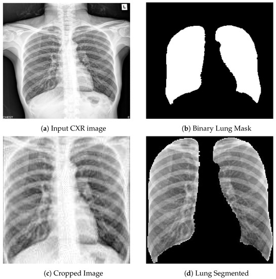 CheXpedition: Investigating Generalization Challenges for Translation of  Chest X-Ray Algorithms to the Clinical Setting