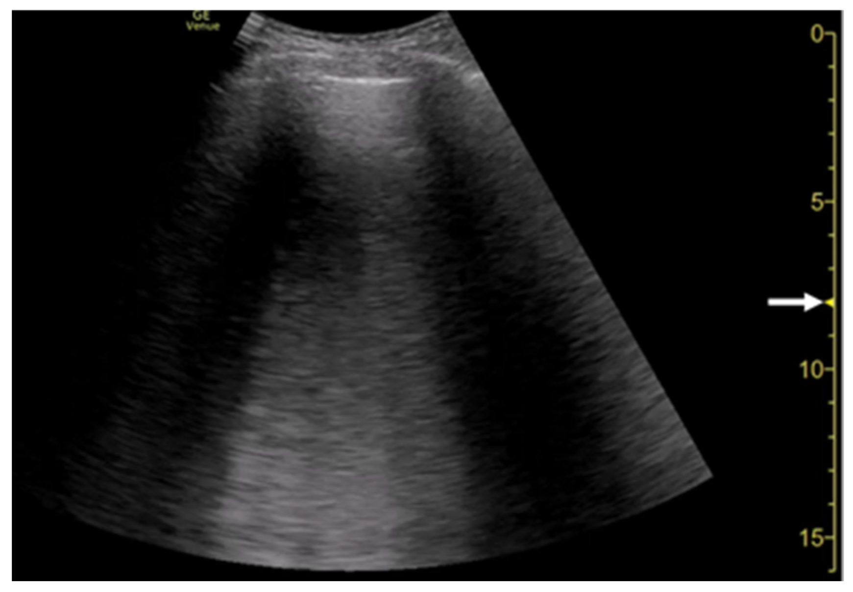curvilinear probe ultrasound slide