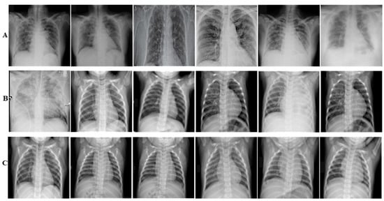 Diagnostics | Free Full-Text | COVID-19 Detection in Chest X-ray