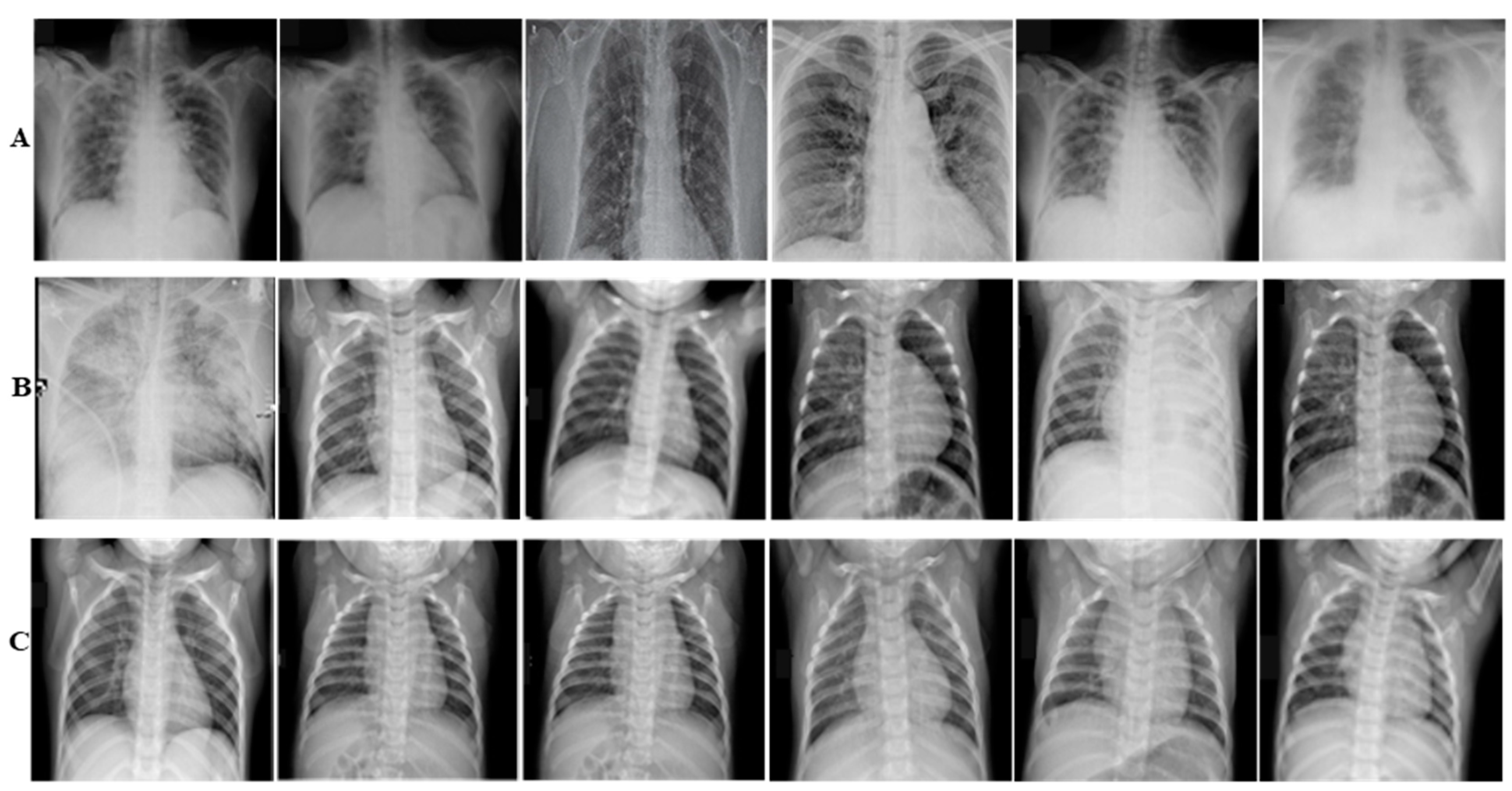 Diagnostics | Free Full-Text | COVID-19 Detection in Chest X-ray