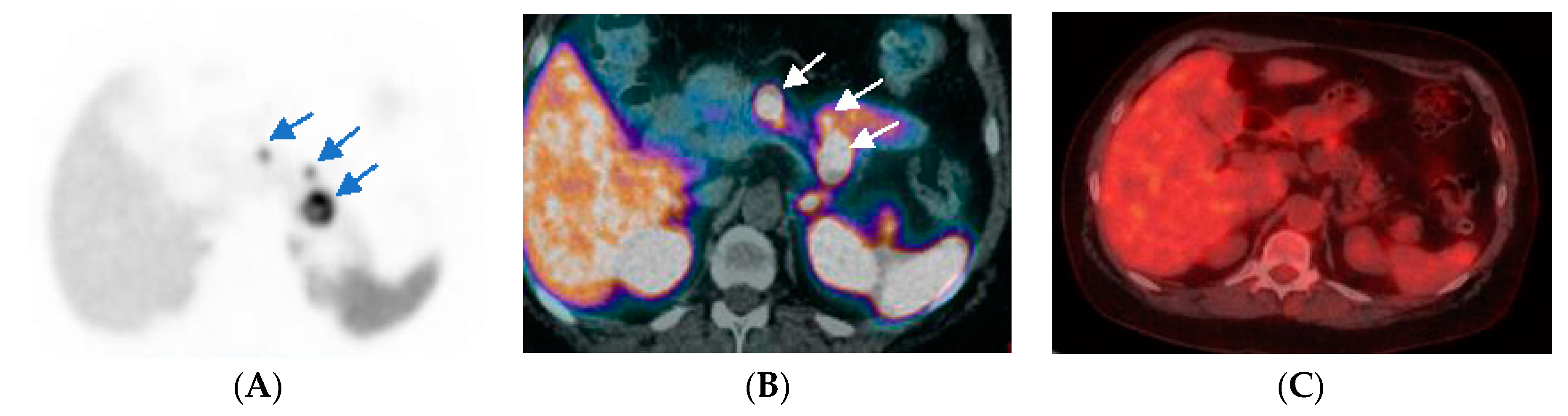 Diagnostics 12 00280 g002 Diagnostics 12 00280 g002
