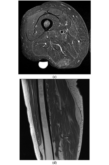 Diagnostics | Free Full-Text | Magnetic Resonance Imaging or