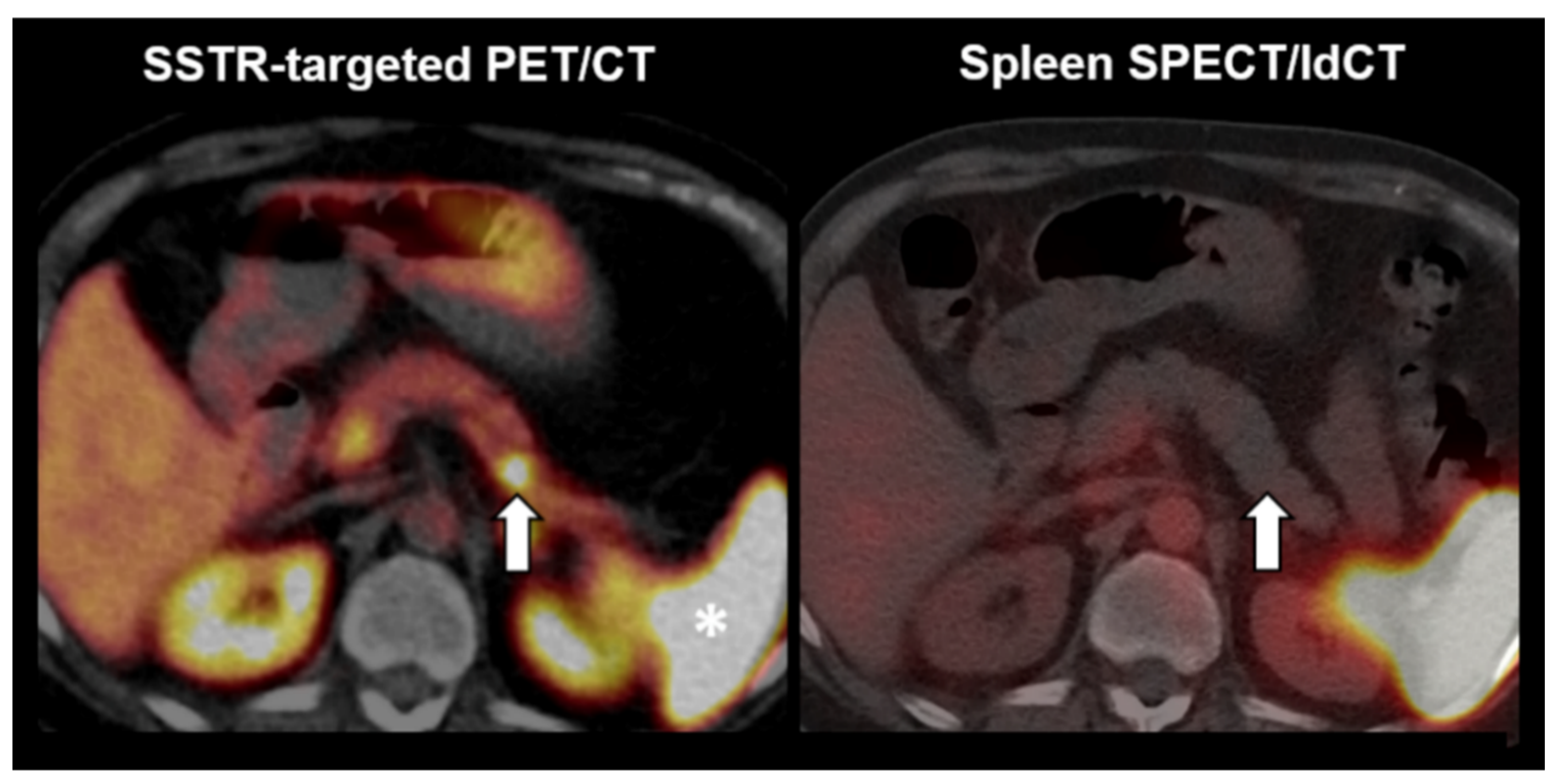 Diagnostics Free Full Text Detection Of Splenic Tissue Using 99mtc