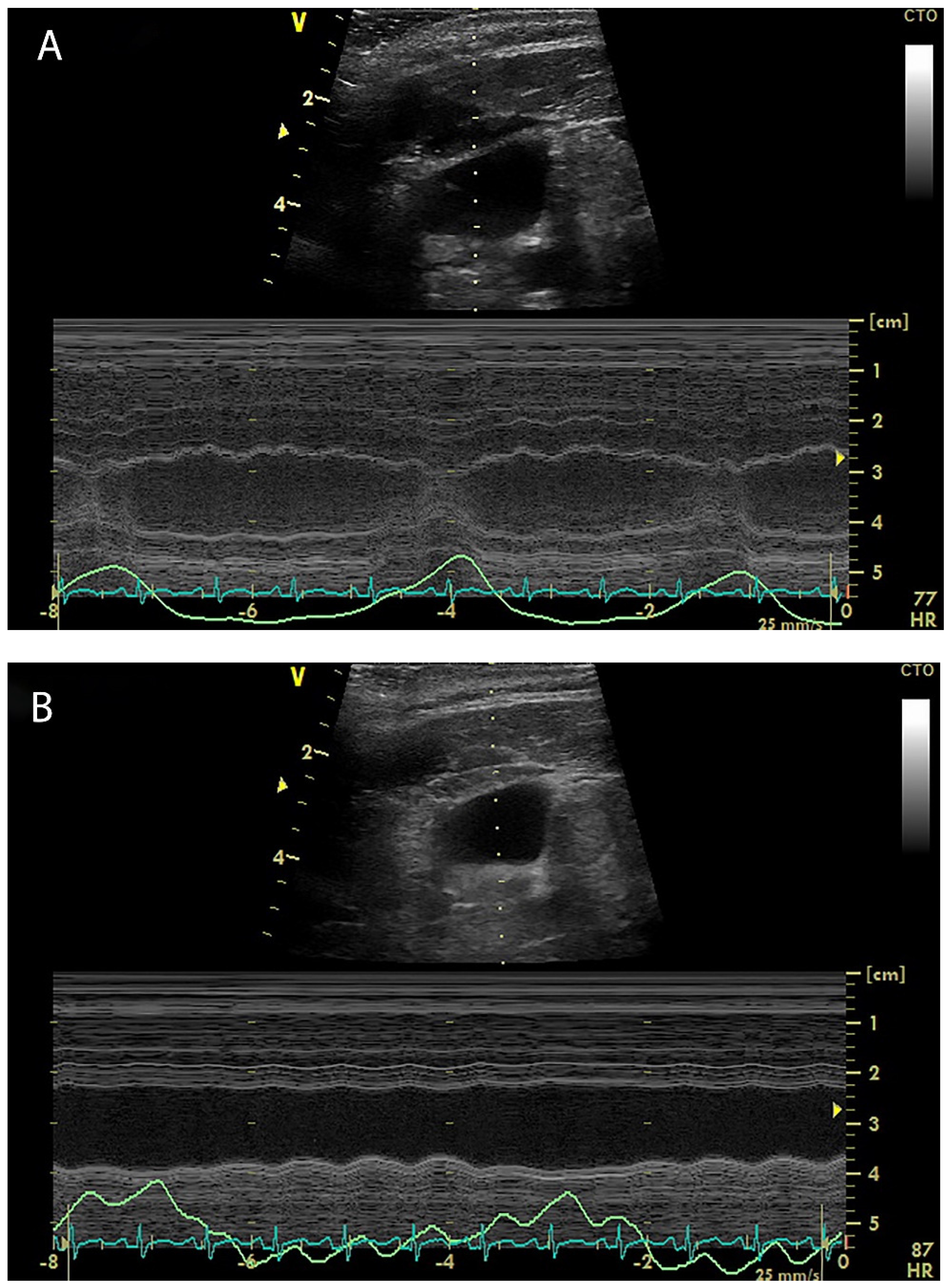 Diagnostics 12 00513 g002