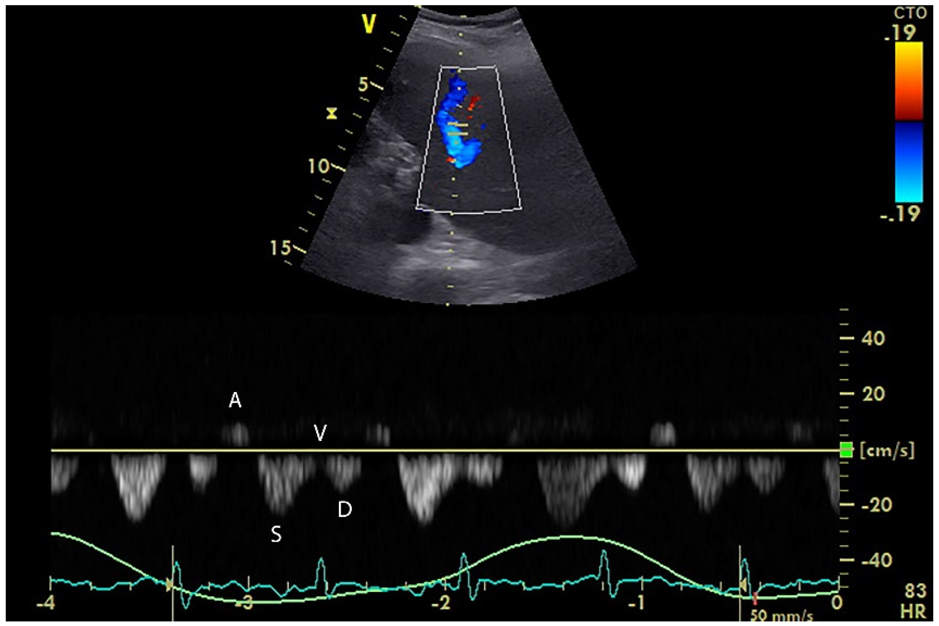 Diagnostics 12 00513 g004