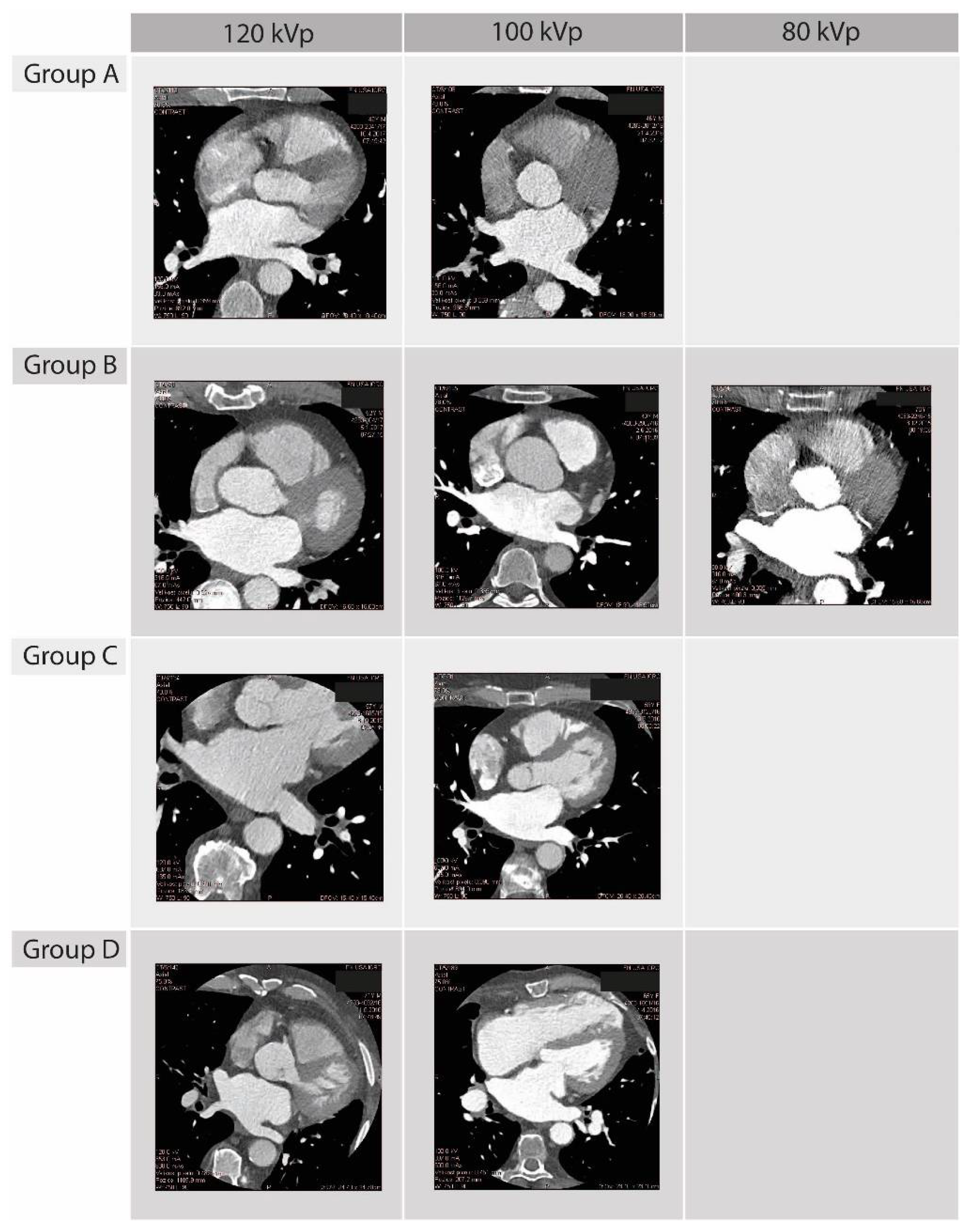 Diagnostics 12 00612 g001