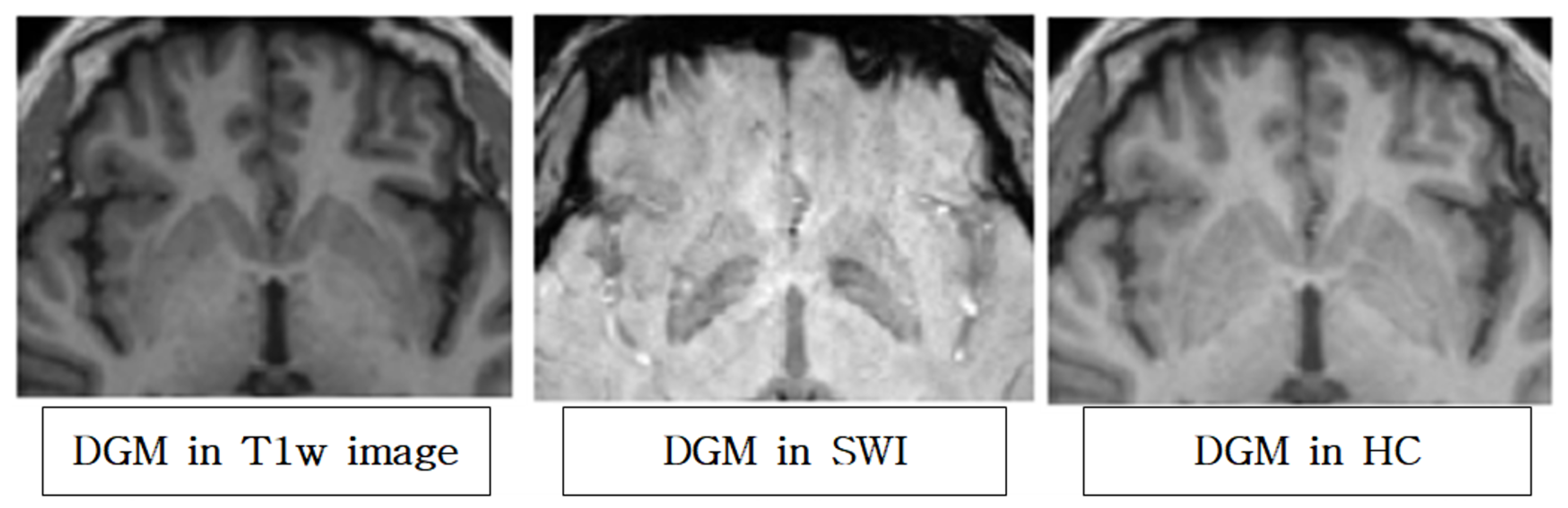 Diagnostics 12 00637 g004