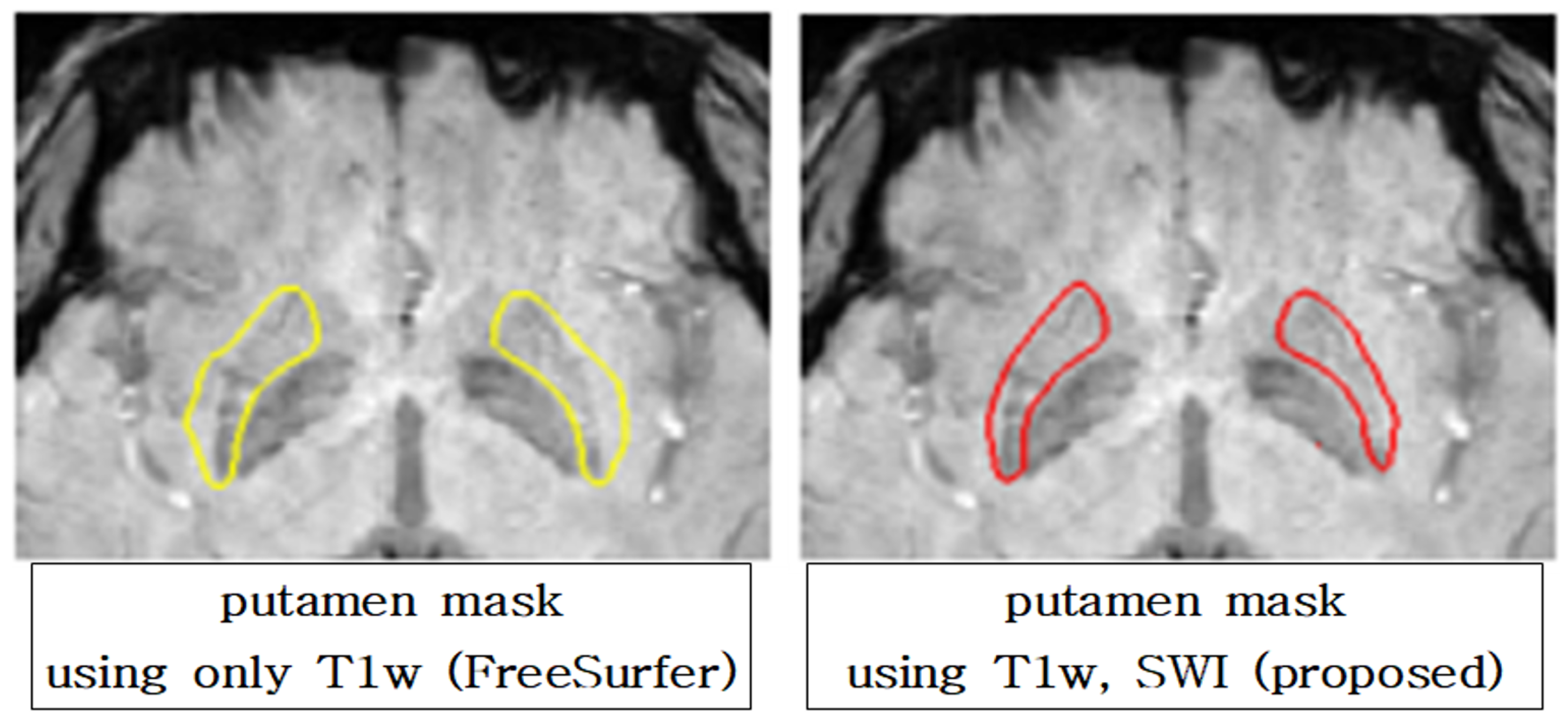 Diagnostics 12 00637 g005