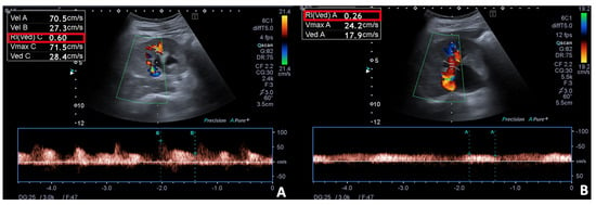 Suspect flank pain? Consider ultrasound for first-line imaging • APPLIED  RADIOLOGY