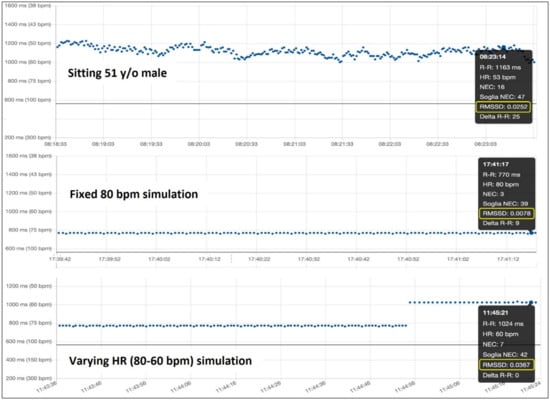 Diagnostics Free Full Text Commercially Available Heart Rate Monitor Repurposed For Automatic Arrhythmia Detection With Snapshot Electrocardiographic Capability A Pilot Validation Html