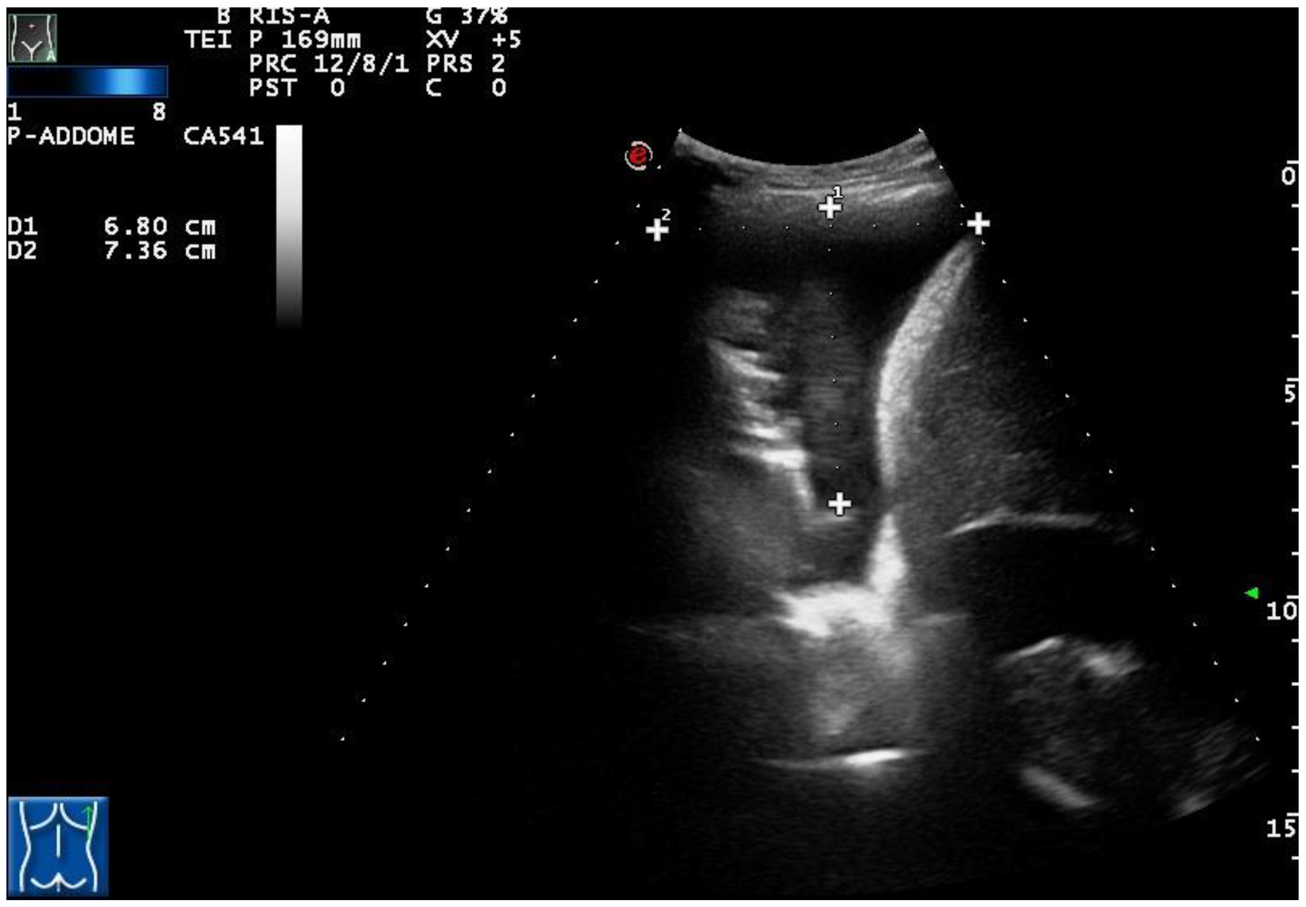 Diagnostics Free Full Text Effectiveness And Safety Of Real Time Transthoracic Ultrasound