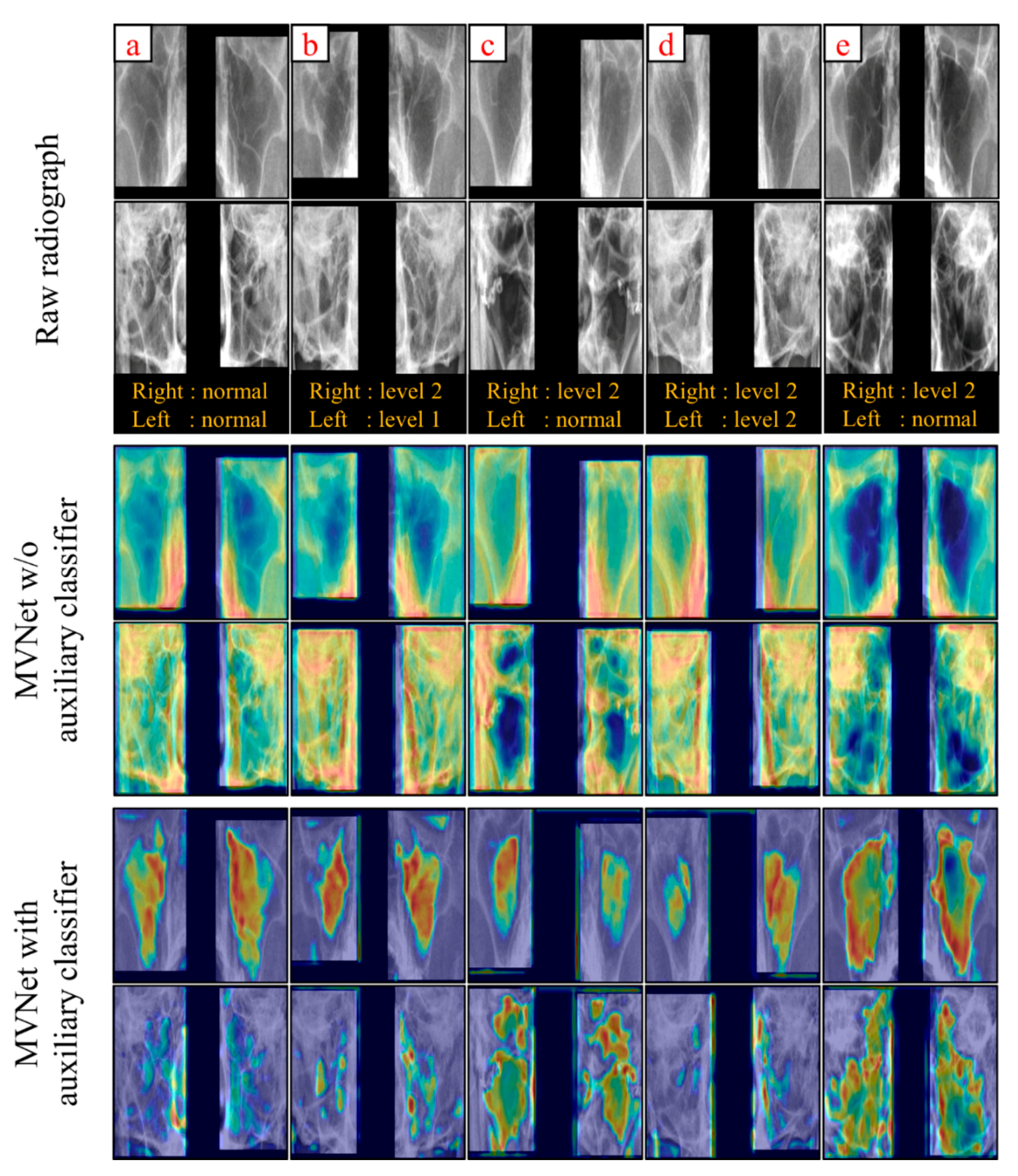 Diagnostics 12 00736 g005