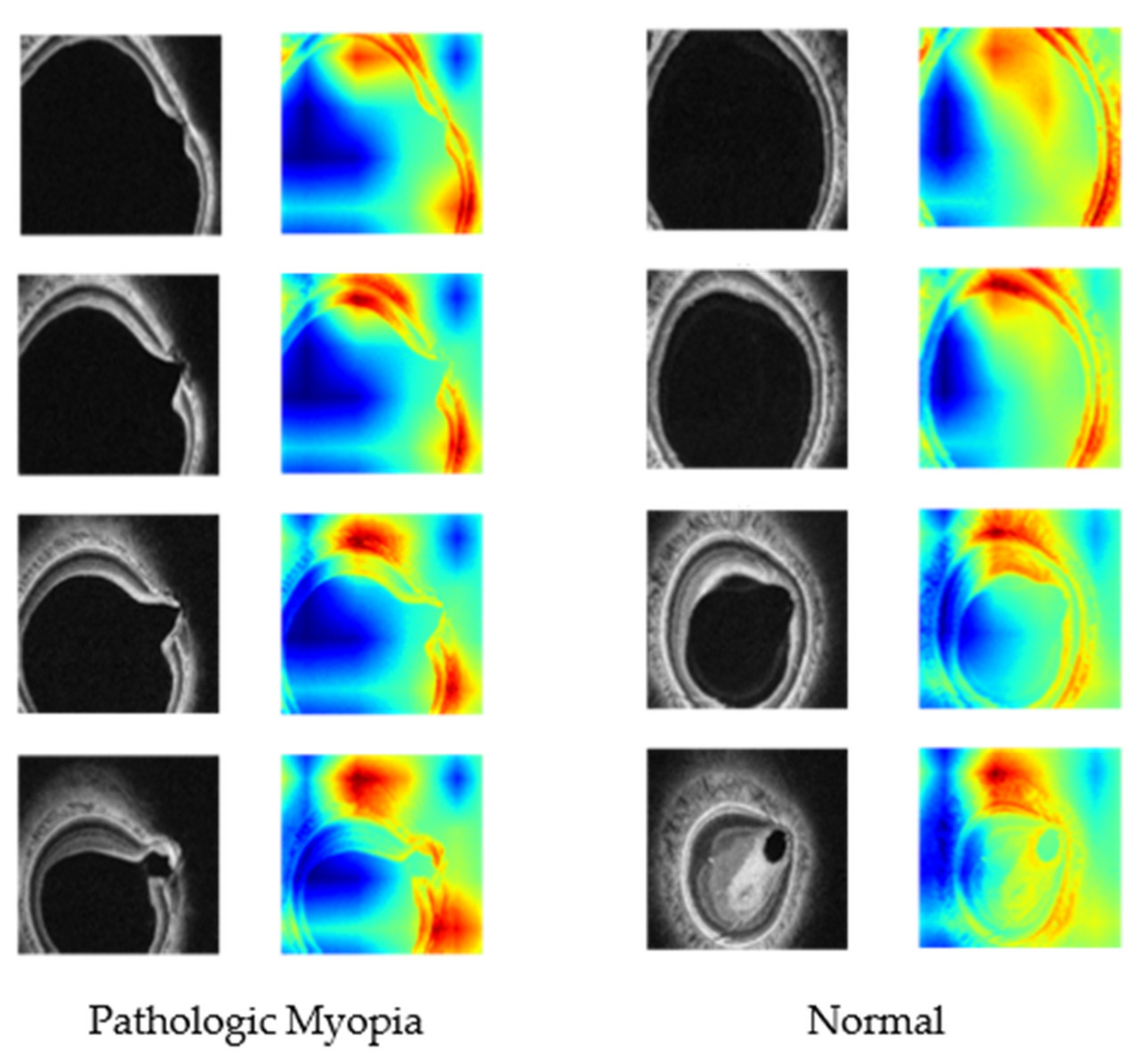 Diagnostics | Free Full-Text | Deep Learning Model Based on 3D