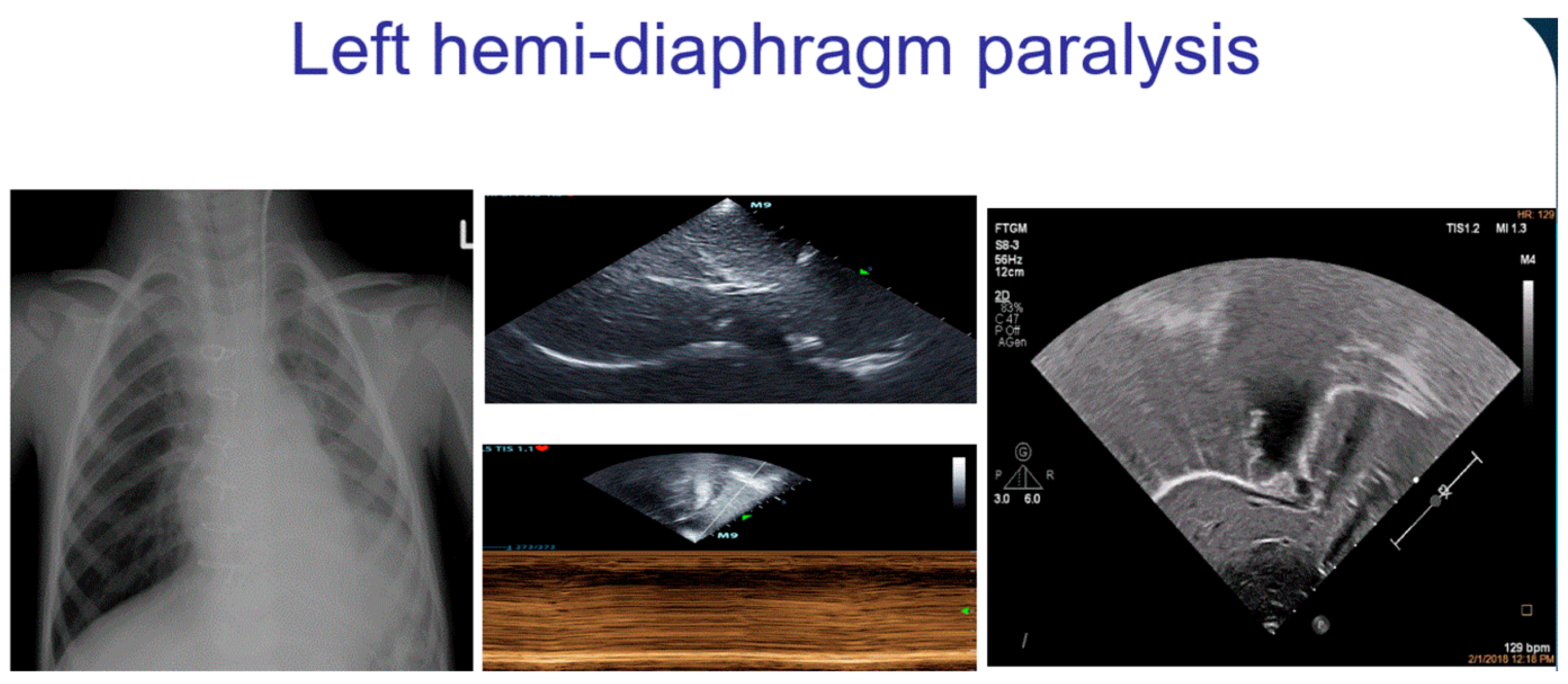 Diagnostics 12 00763 g006