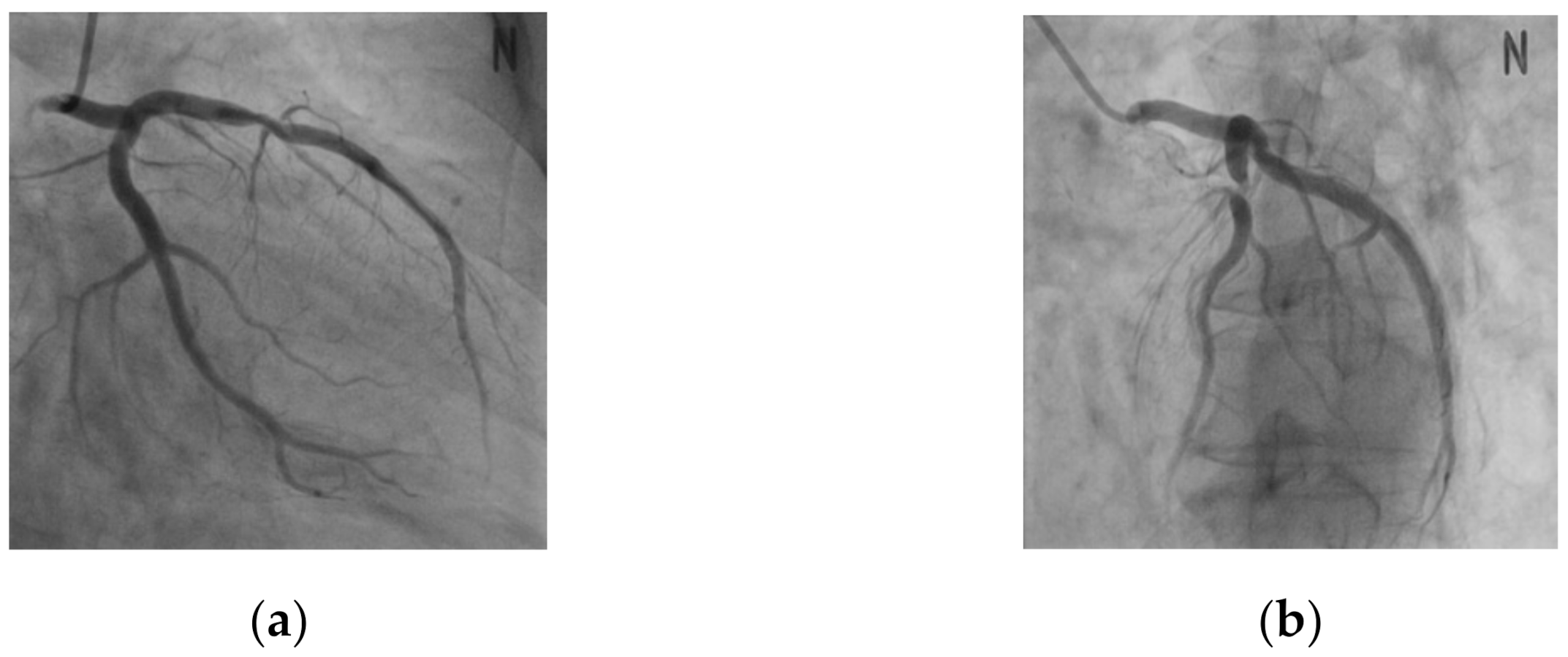 Blood vessel model for contrast medium - Accessories - X-ray