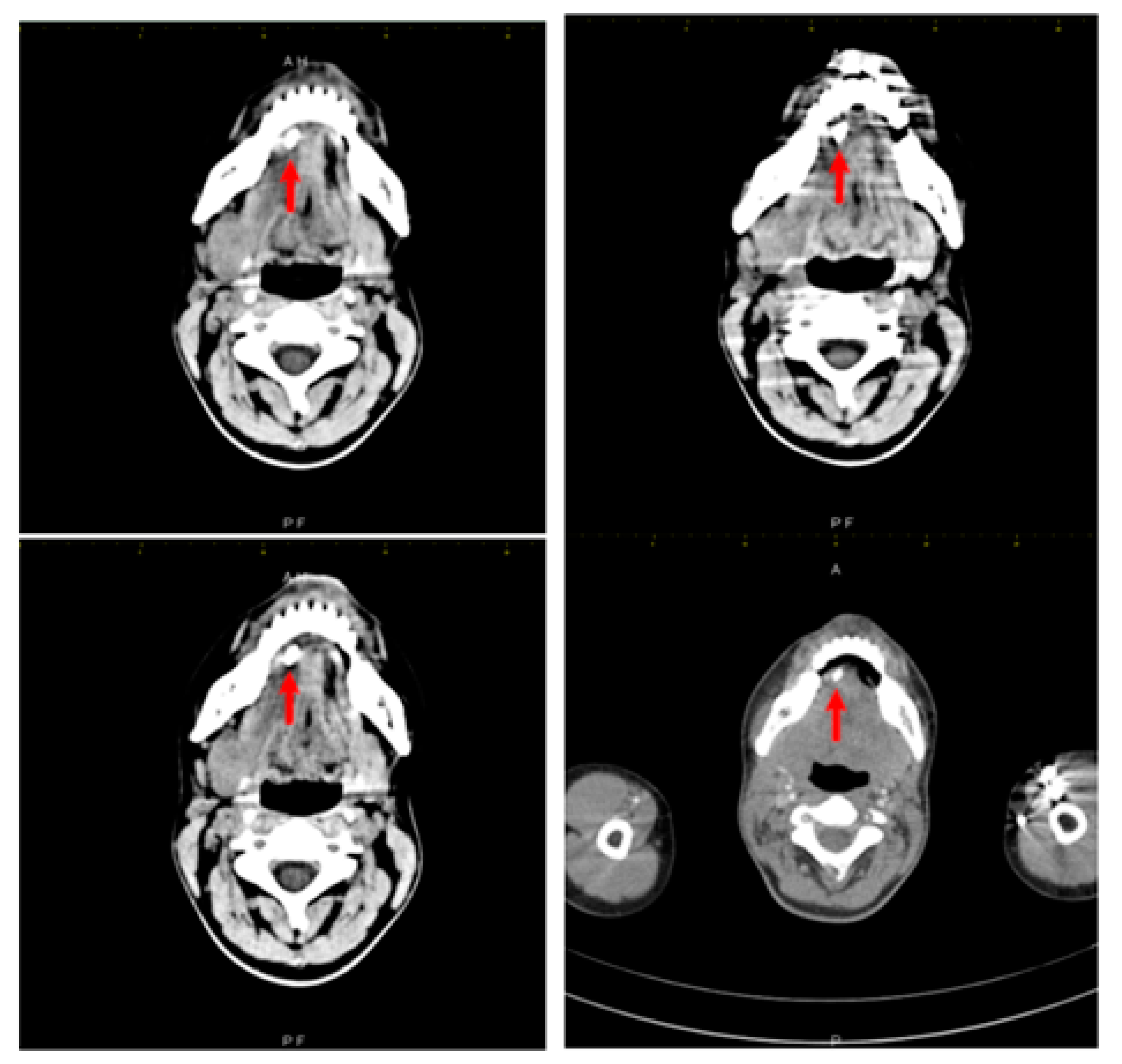 Diagnostics 12 00792 g002 Diagnostics 12 00792 g002