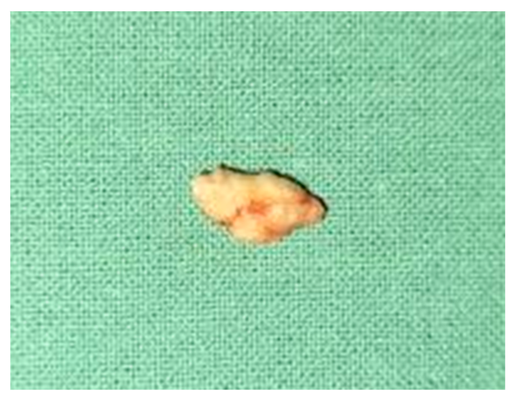 Diagnostics 12 00792 g004 Diagnostics 12 00792 g004