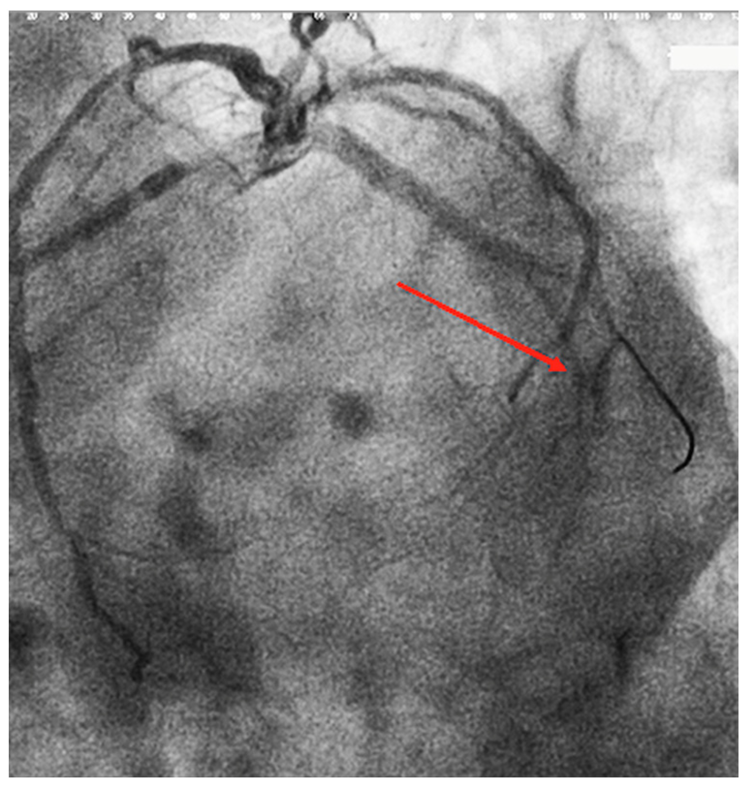 Diagnostics 12 00932 g005