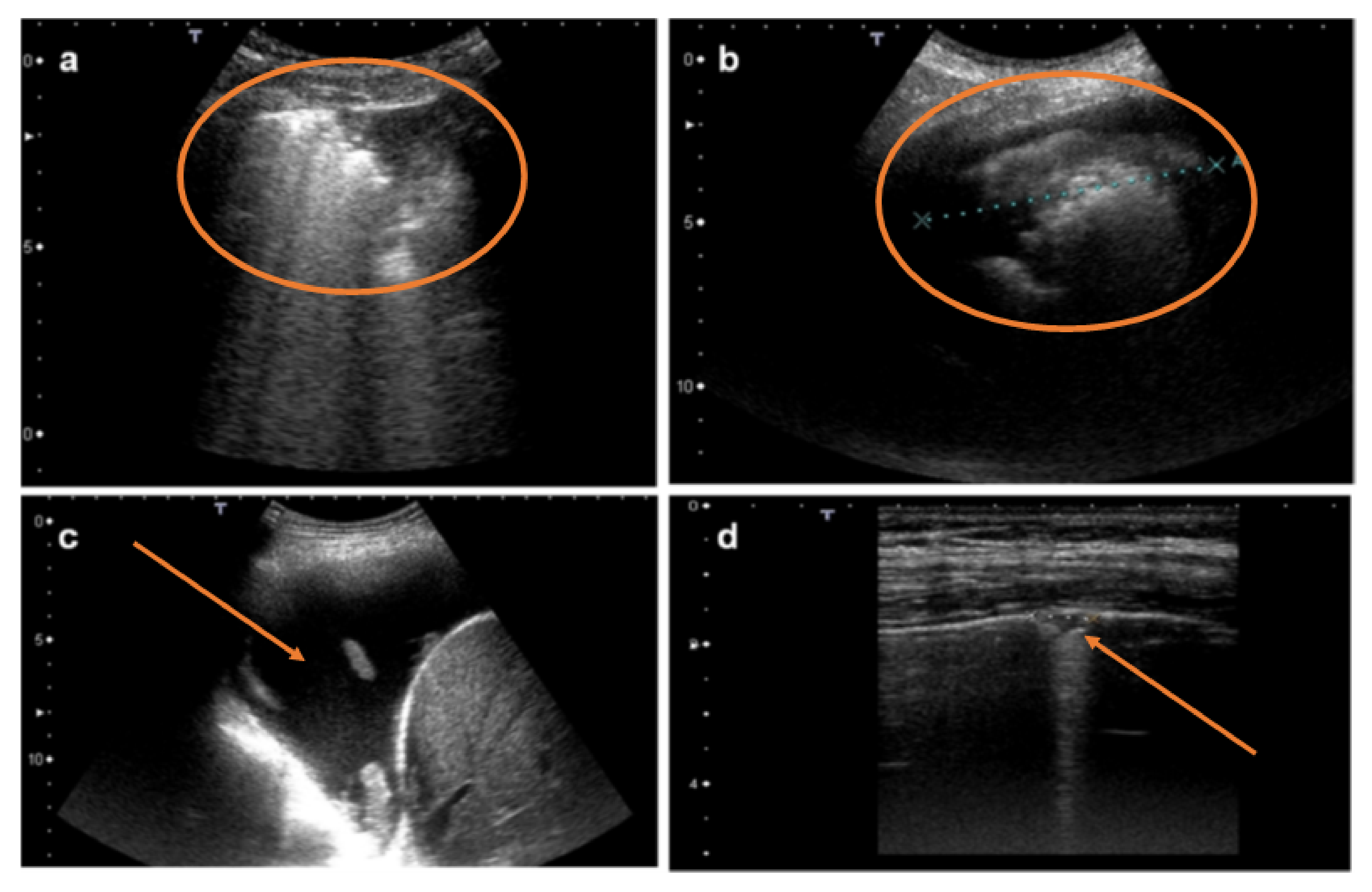 Diagnostics 12 00952 g005