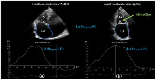 PDF] Normal values and clinical relevance of left atrial myocardial  function analysed by speckle-tracking echocardiography: multicentre study.