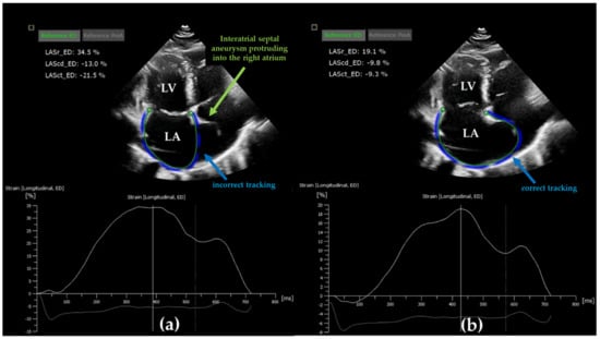 A systematic review and meta-analysis of the normal reference value of the  longitudinal left atrial strain by three dimensional speckle tracking  echocardiography