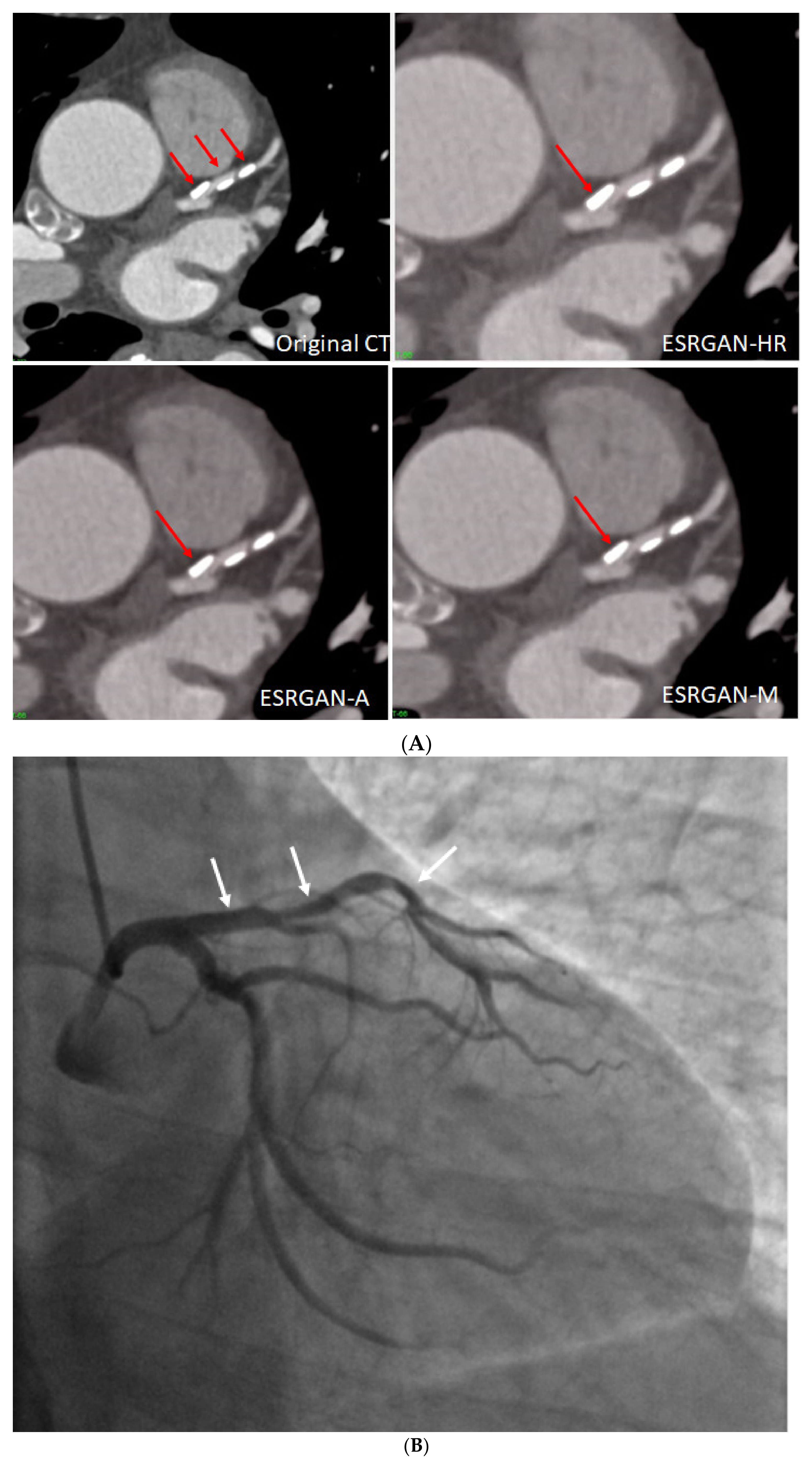 Diagnostics 12 00991 g004 Diagnostics 12 00991 g004