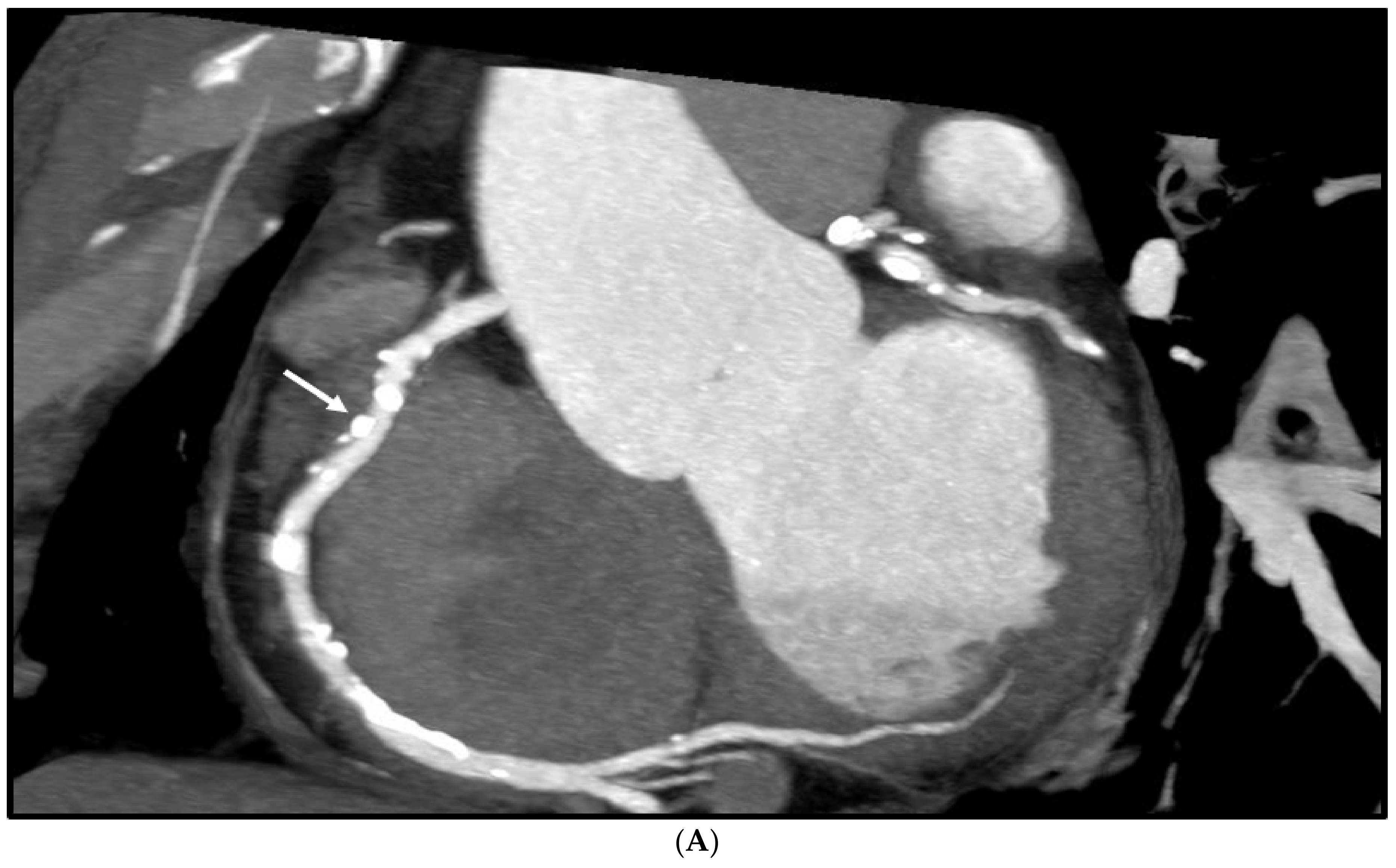 Diagnostics 12 00991 g005a Diagnostics 12 00991 g005a