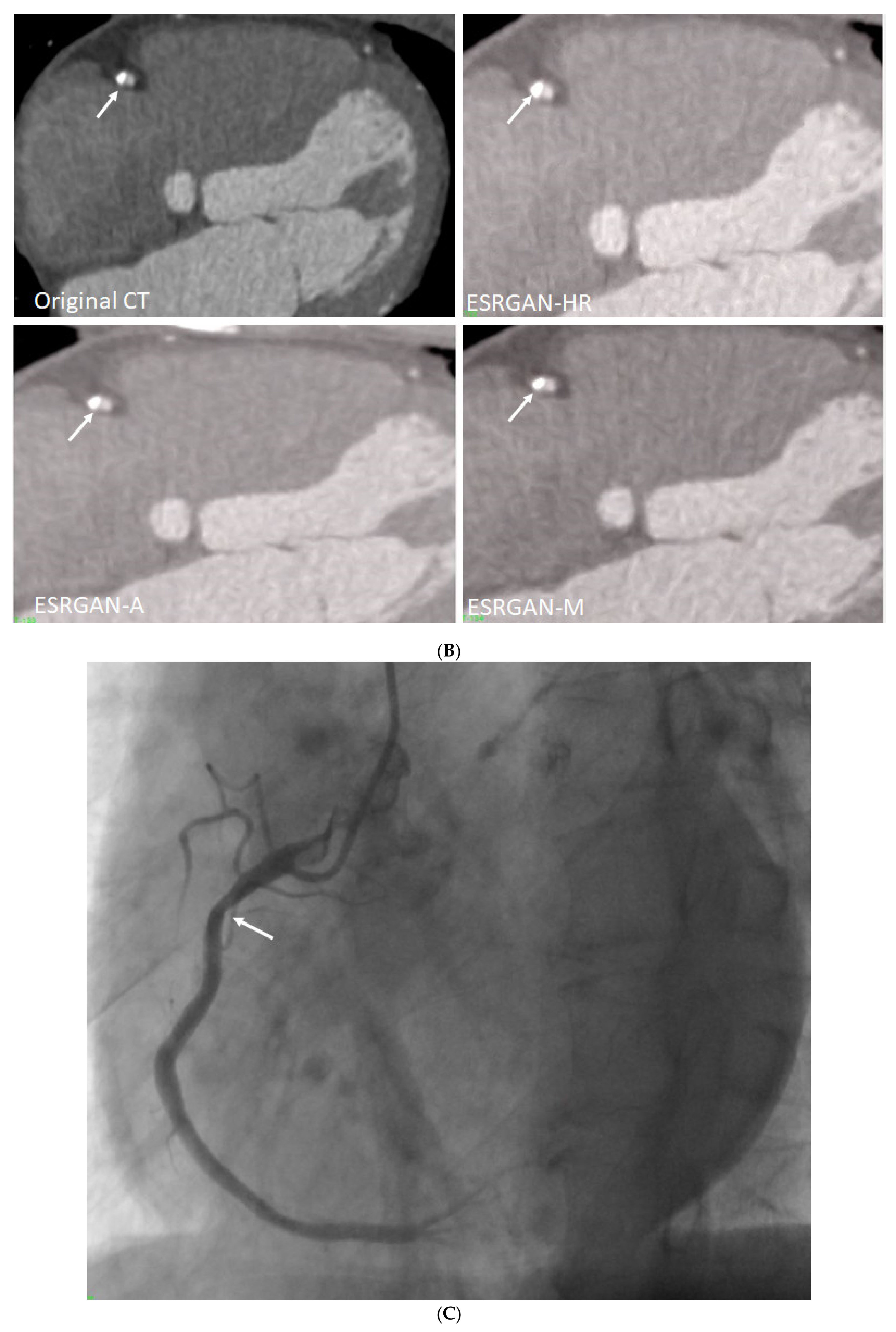 Diagnostics 12 00991 g005b Diagnostics 12 00991 g005b