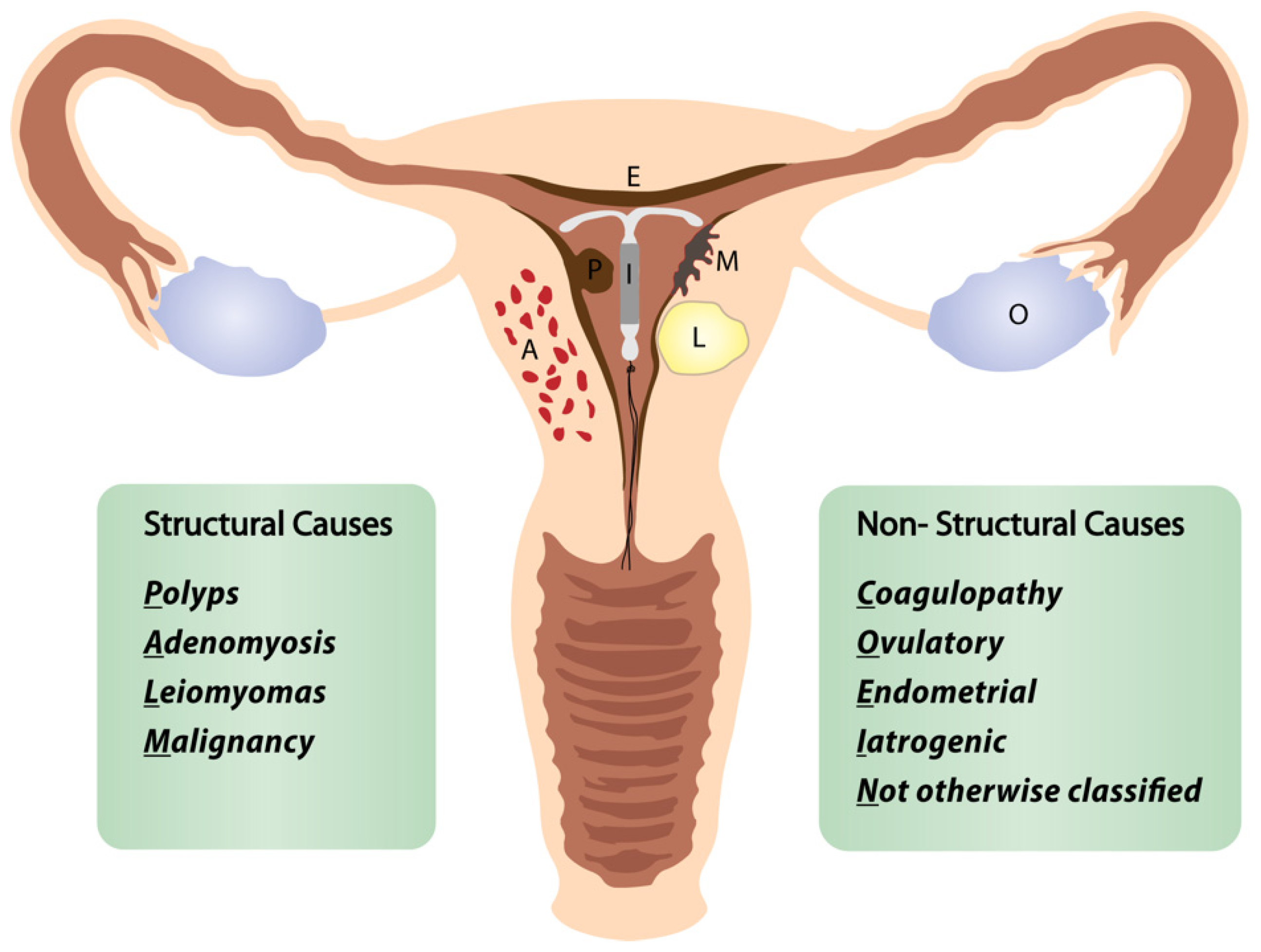 Diagnostics | Free Full-Text | Abnormal Uterine Bleeding in Perimenopausal  Women: The Role of Hysteroscopy and Its Impact on Quality of Life and  Sexuality