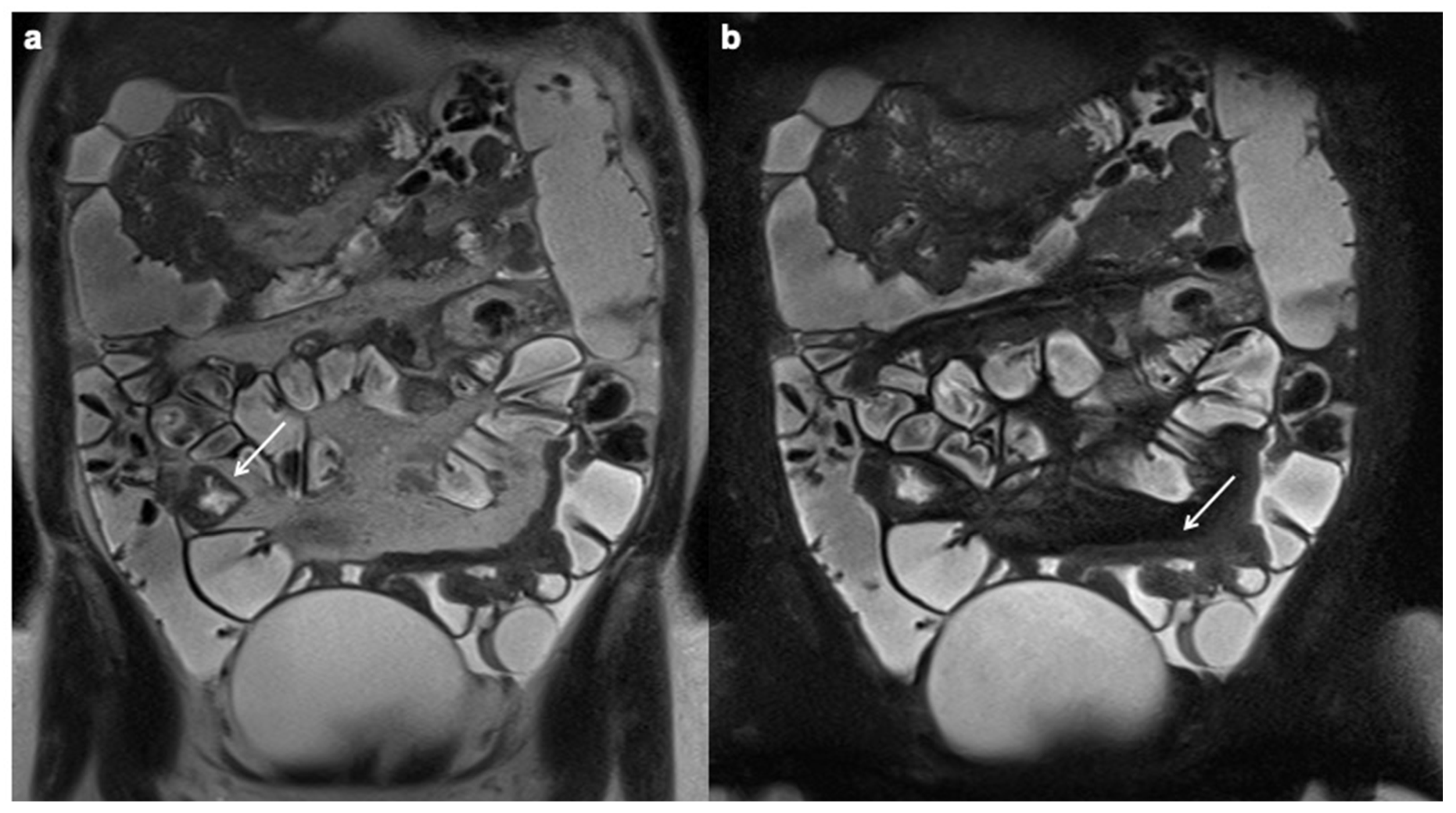 Diagnostics 12 01236 g002