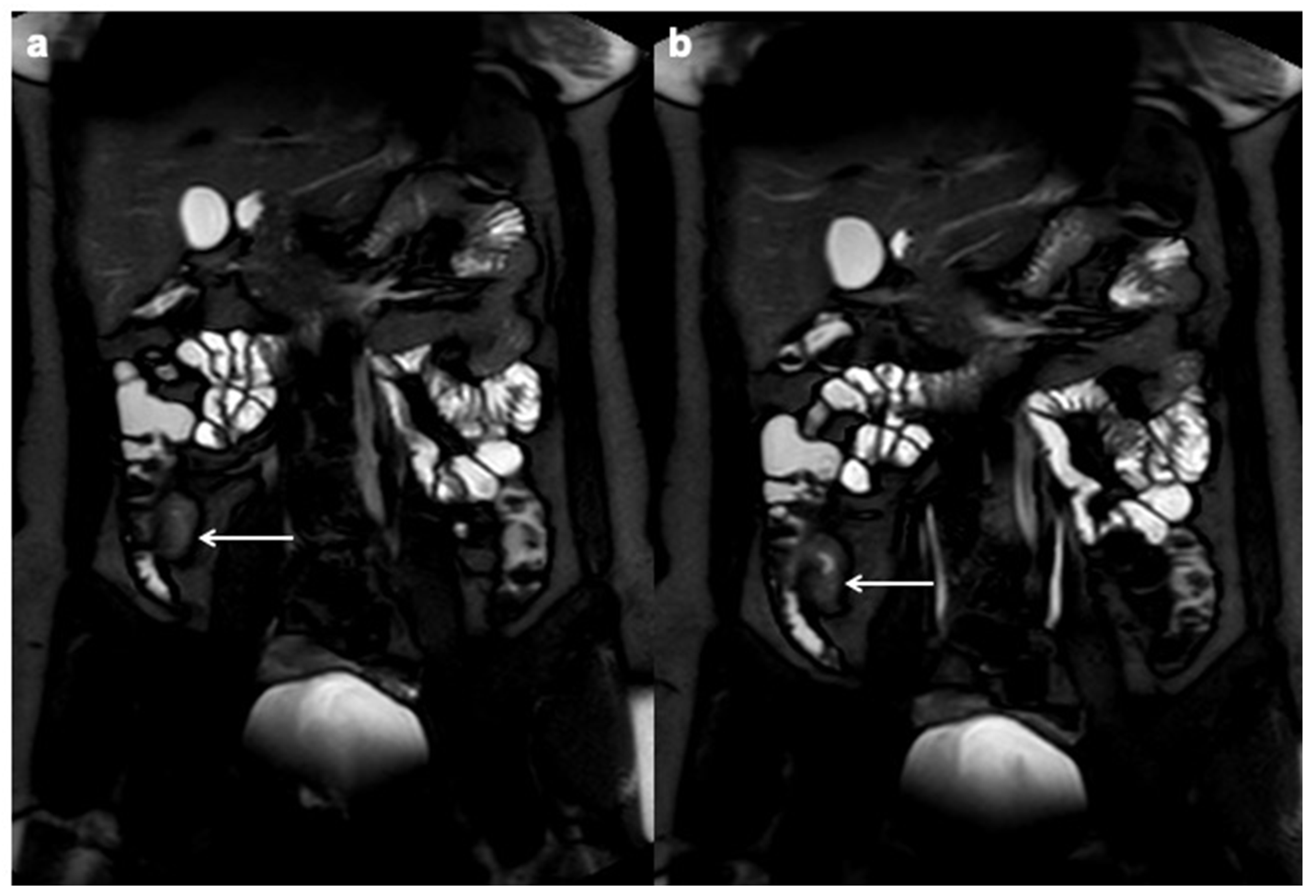 Diagnostics 12 01236 g003