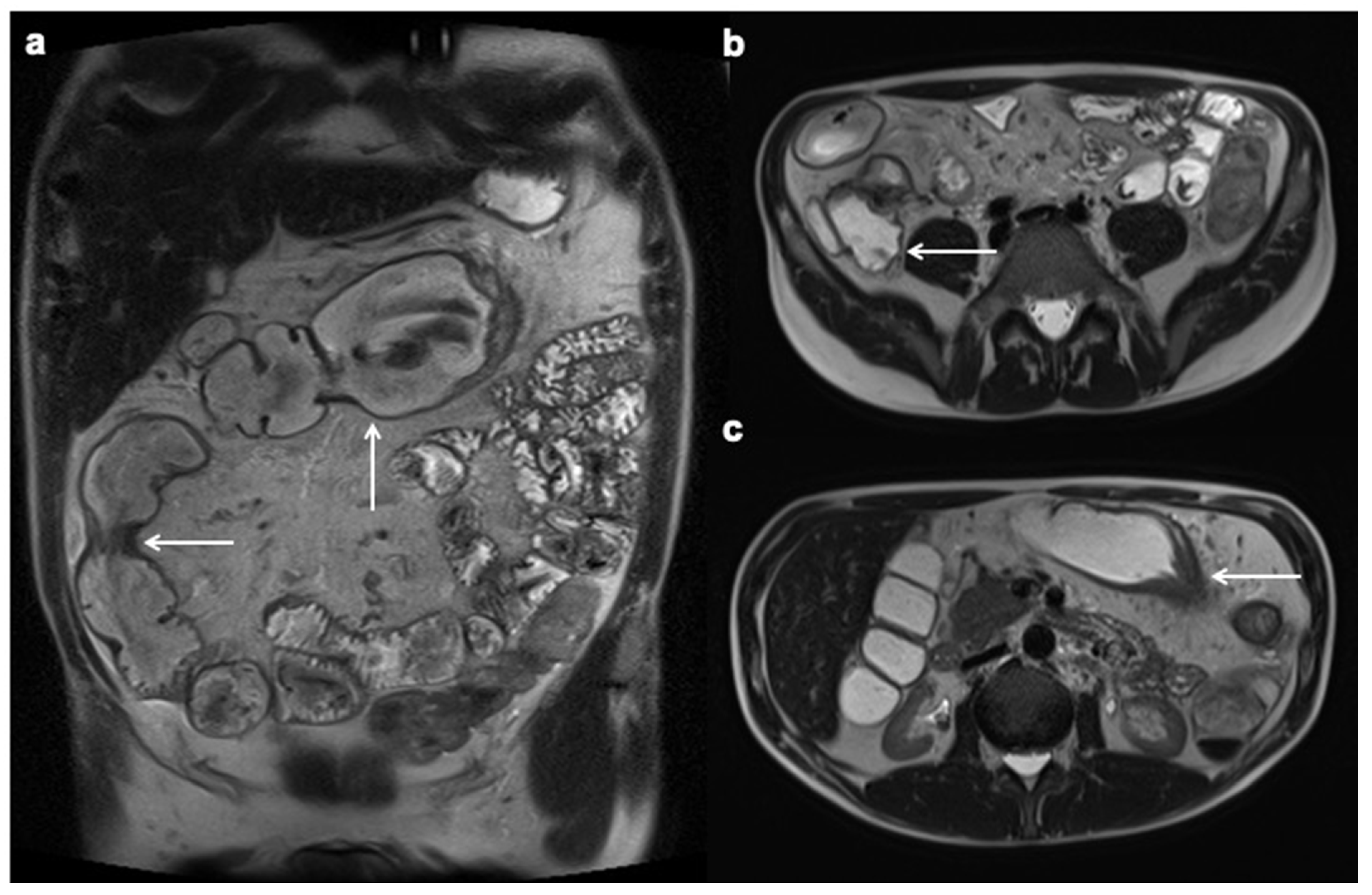 Diagnostics 12 01236 g004