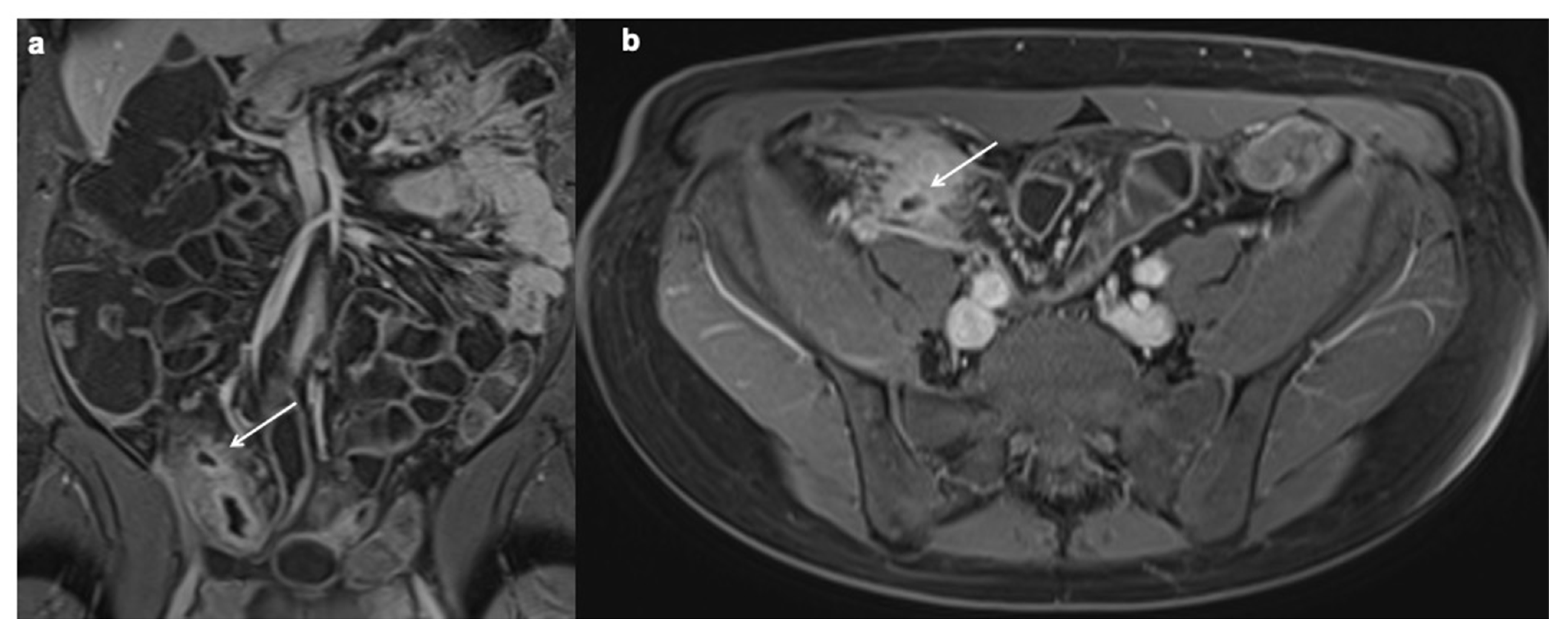 Diagnostics 12 01236 g009
