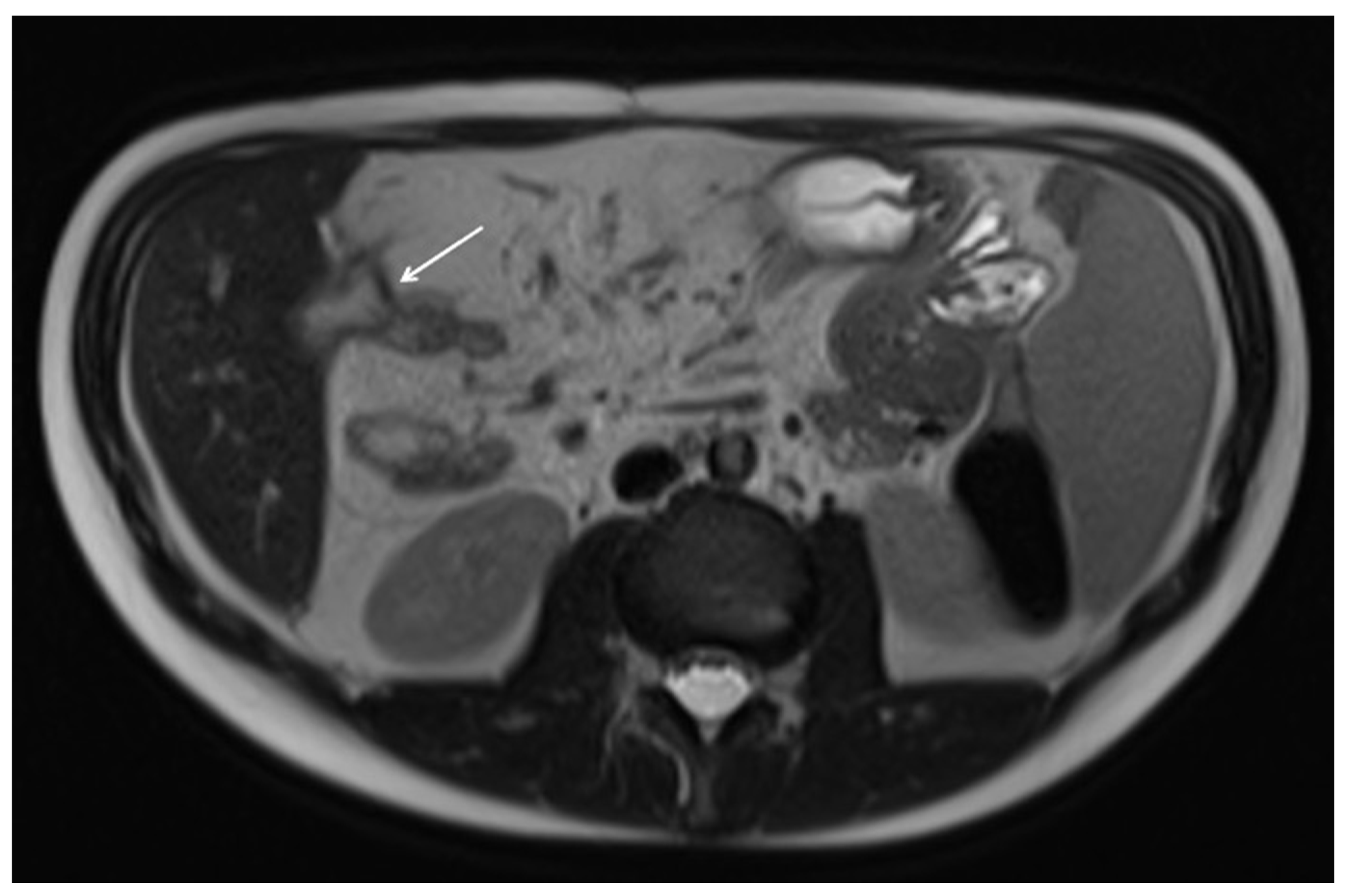 Diagnostics 12 01236 g012