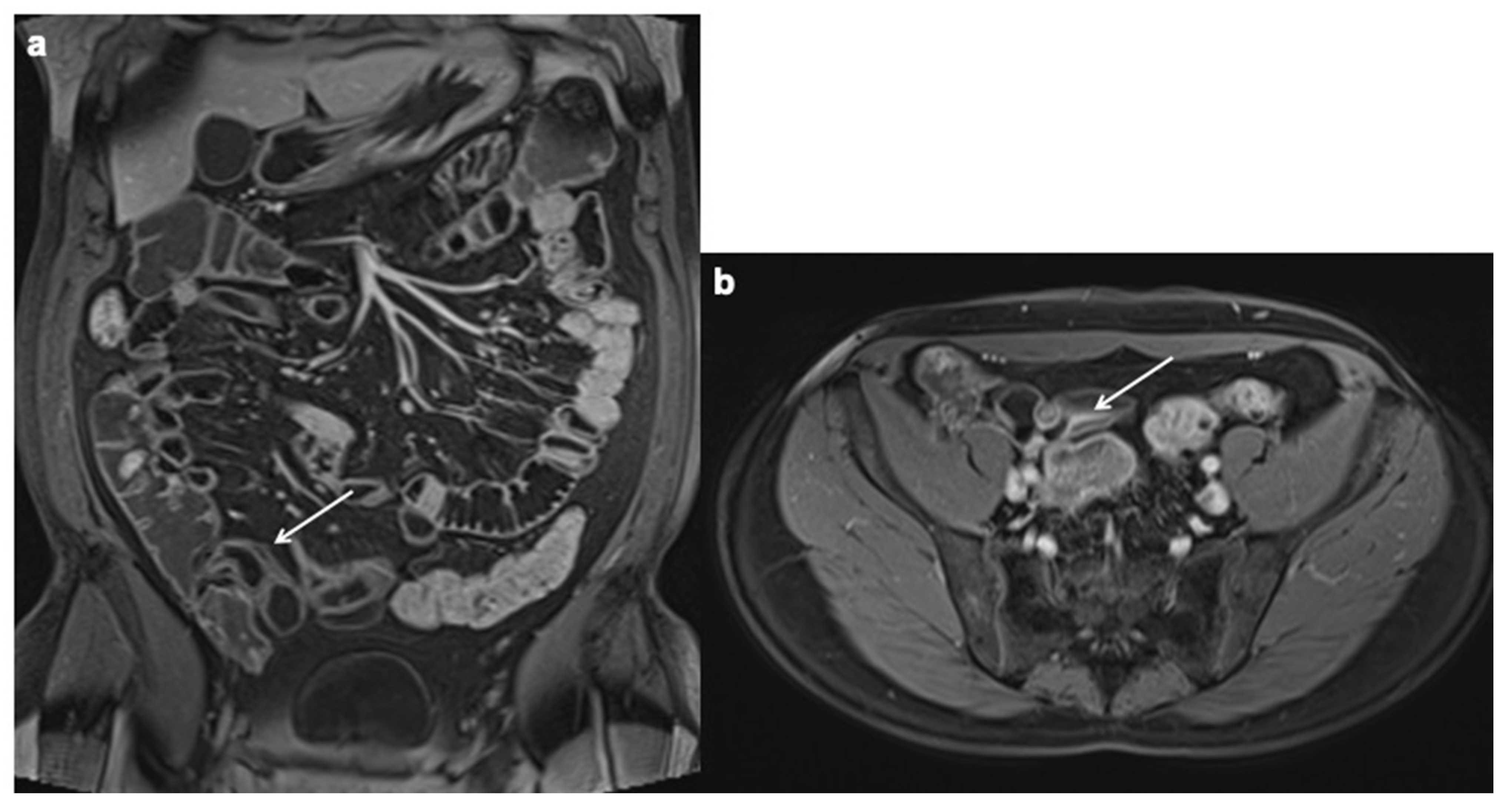 Diagnostics 12 01236 g013