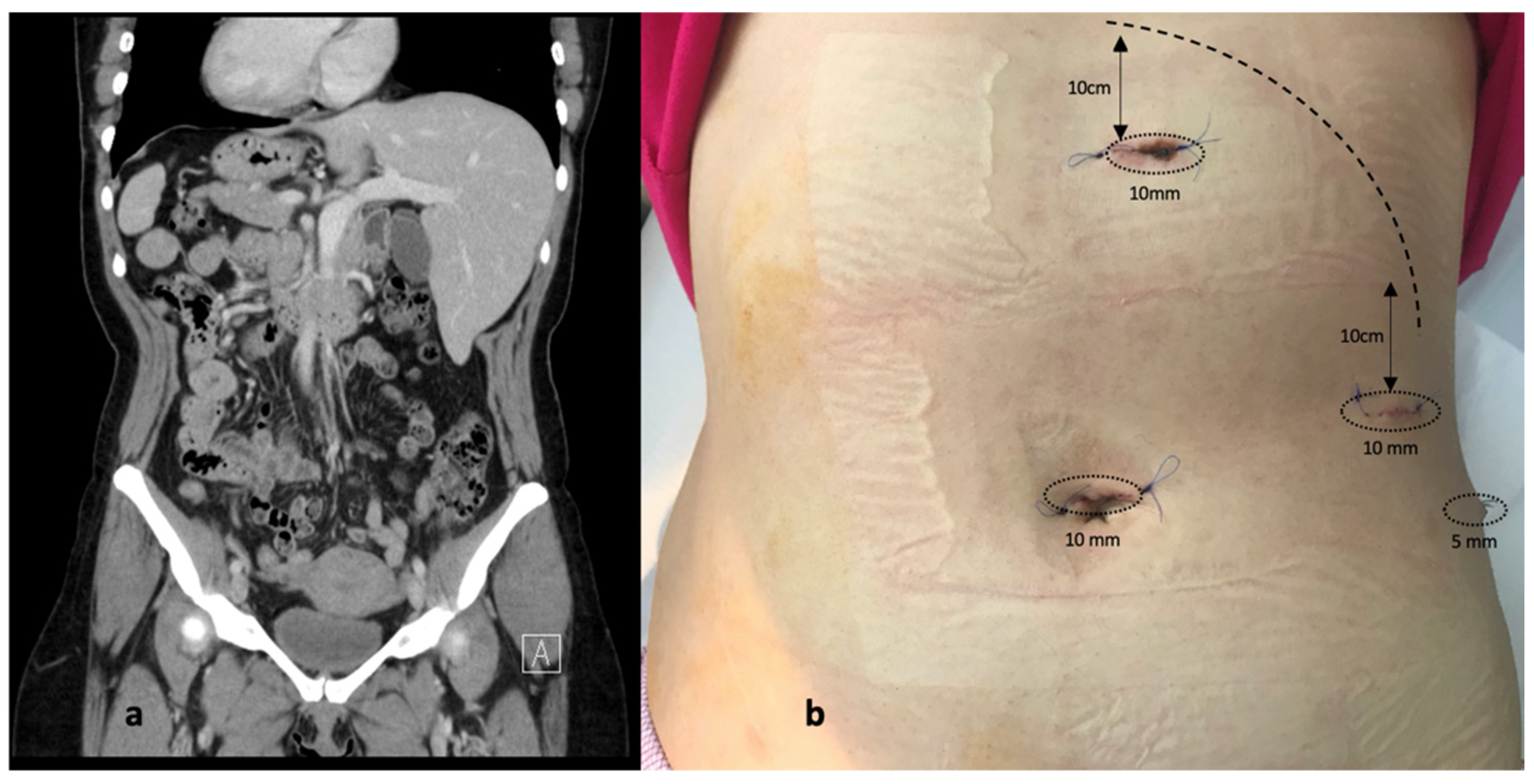 Diagnostics 12 01265 g002 Diagnostics 12 01265 g002