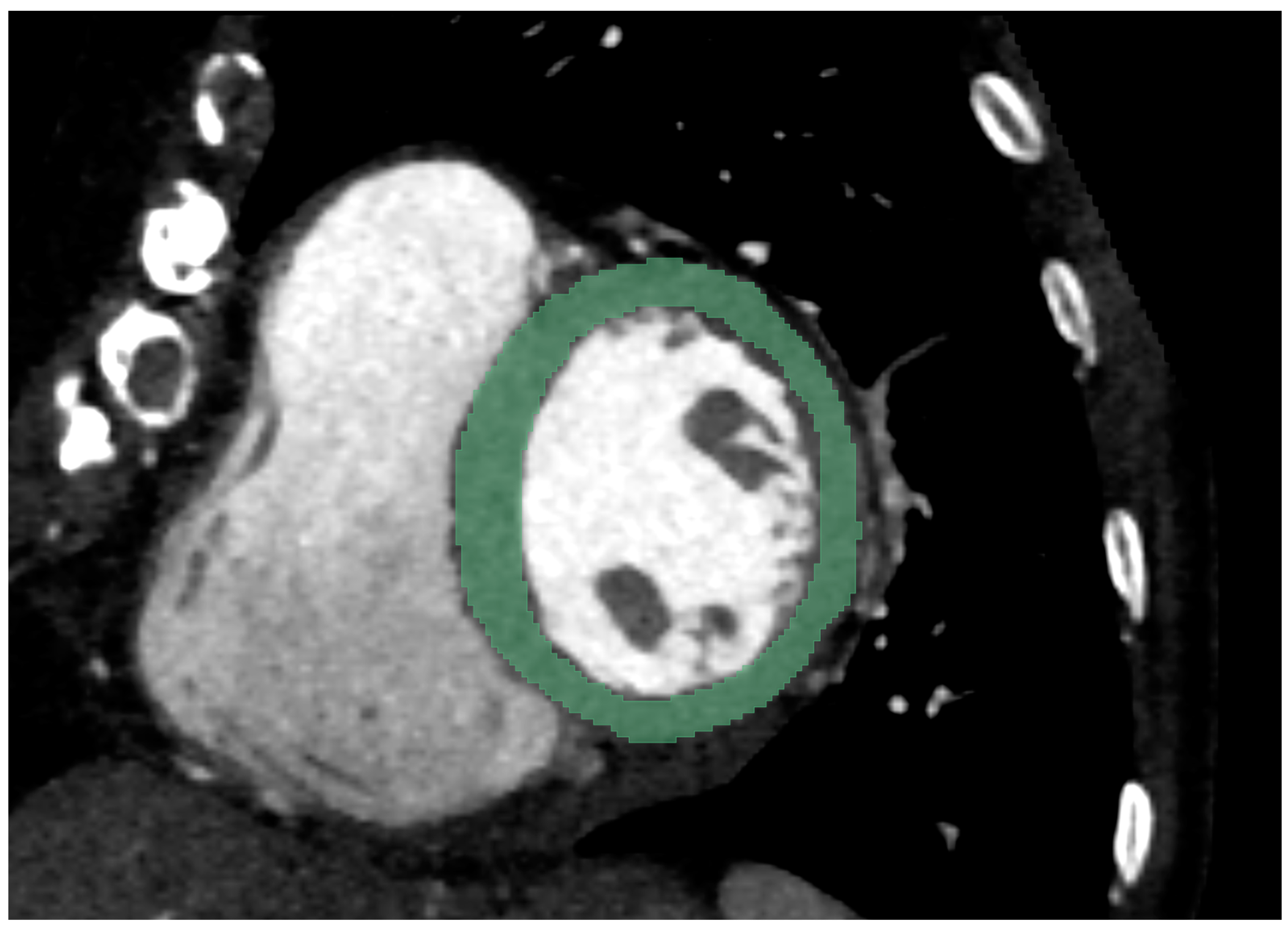 Diagnostics 12 01294 g001