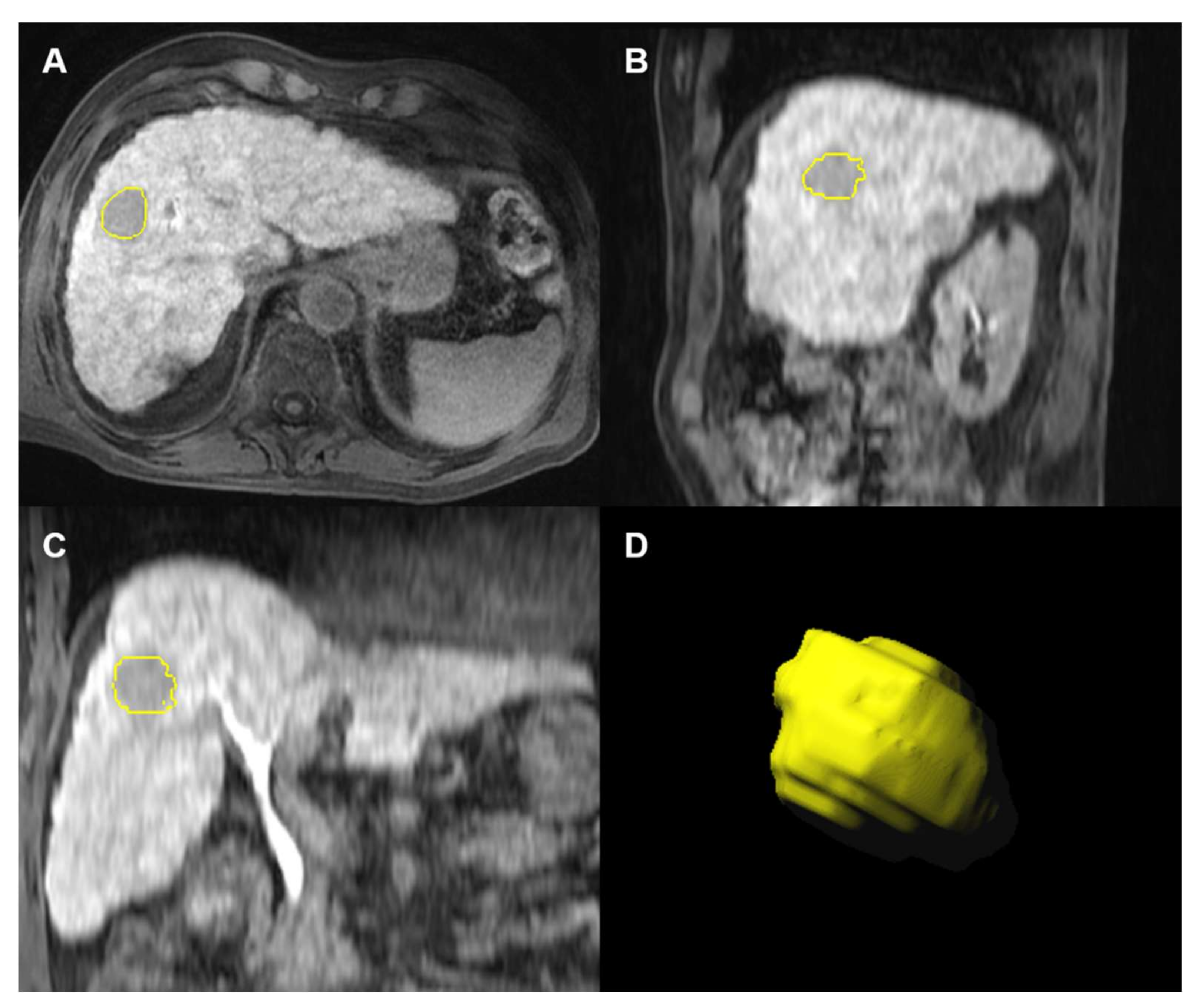 Diagnostics 12 01308 g002