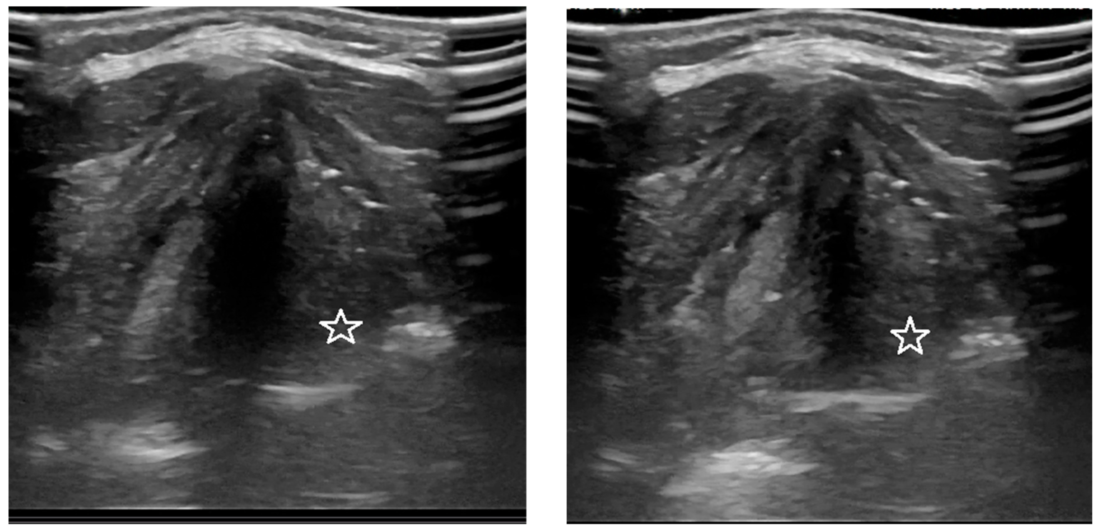 Diagnostics 12 01362 g002