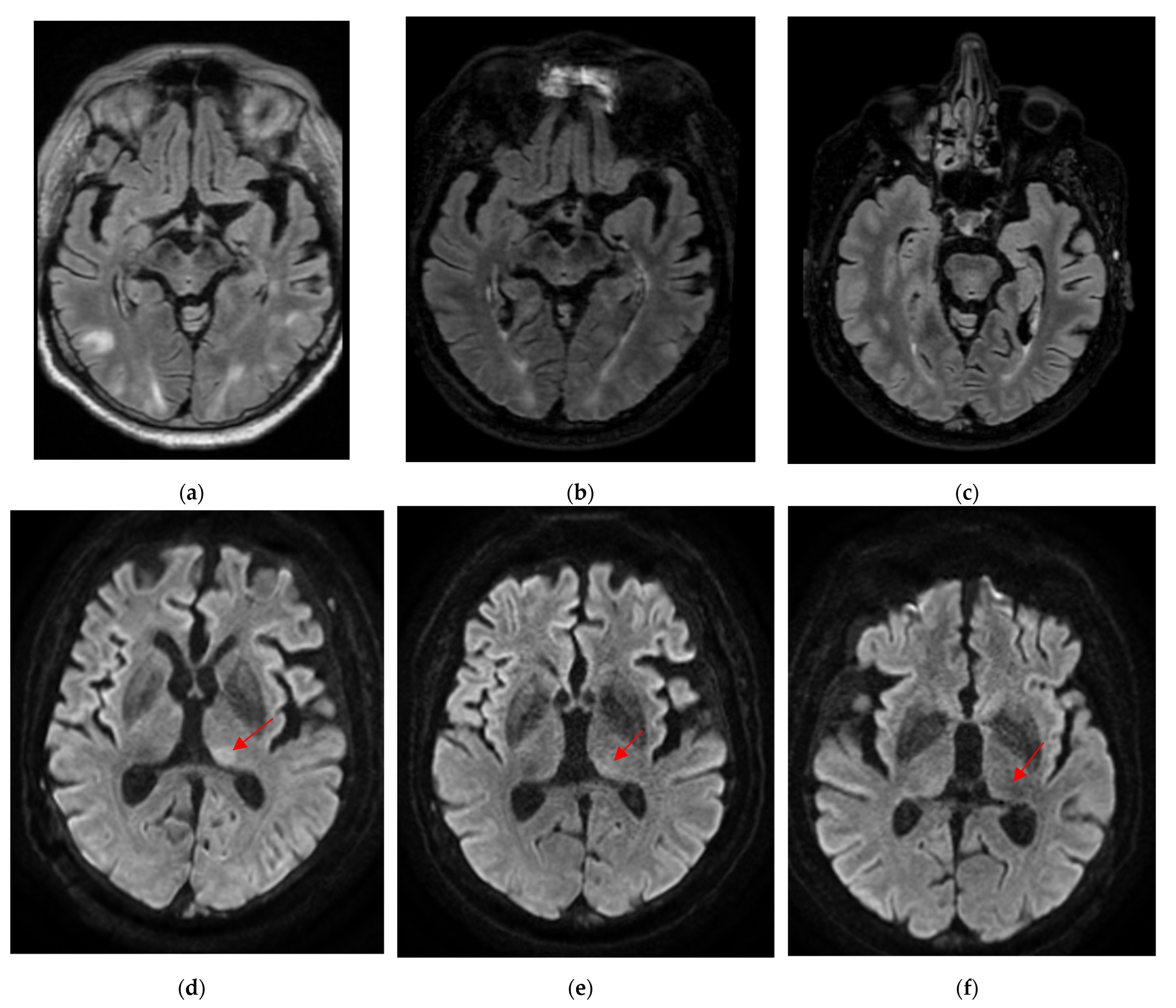 Diagnostics 12 01369 g005