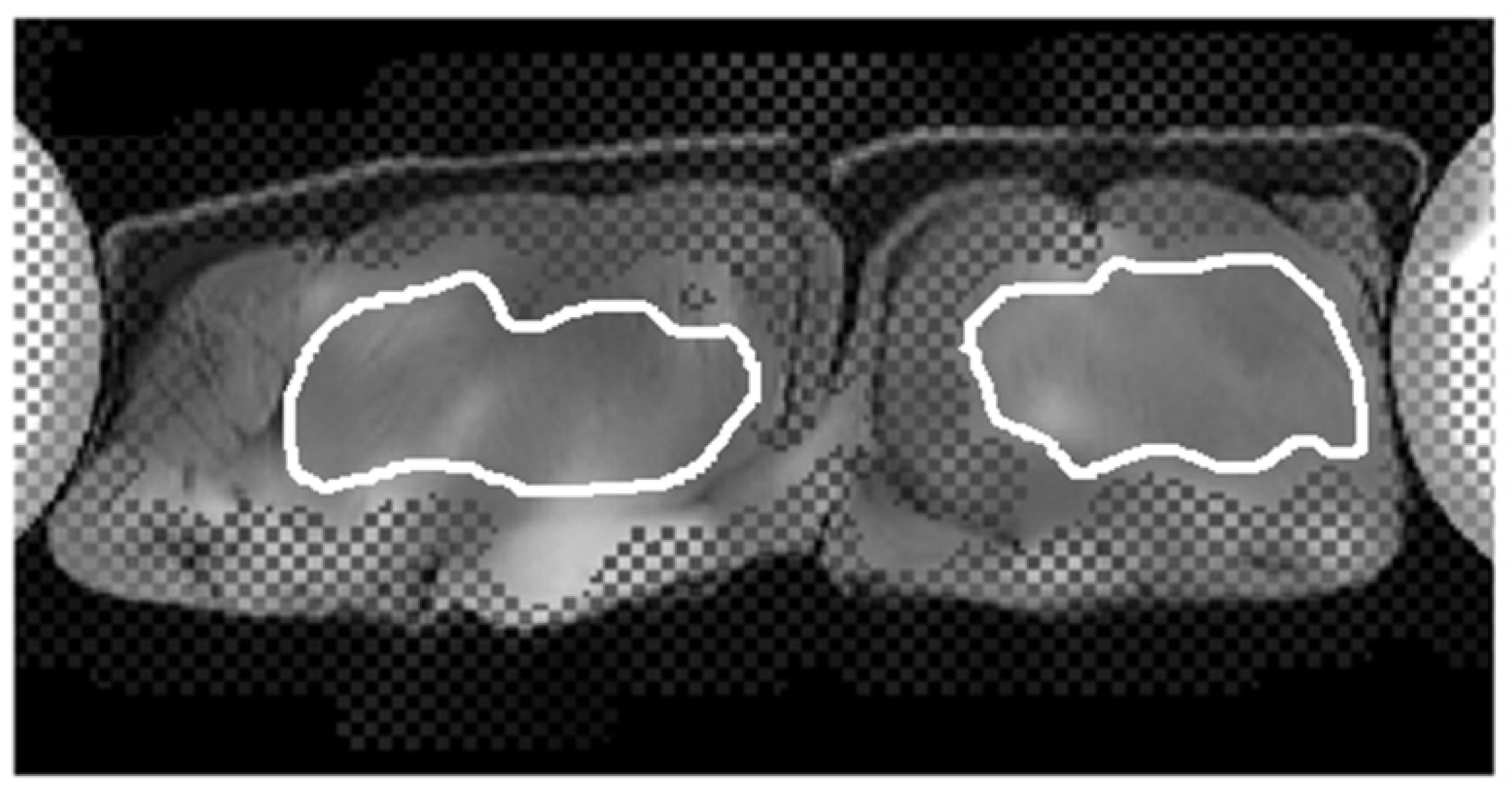 Diagnostics 12 01385 g004