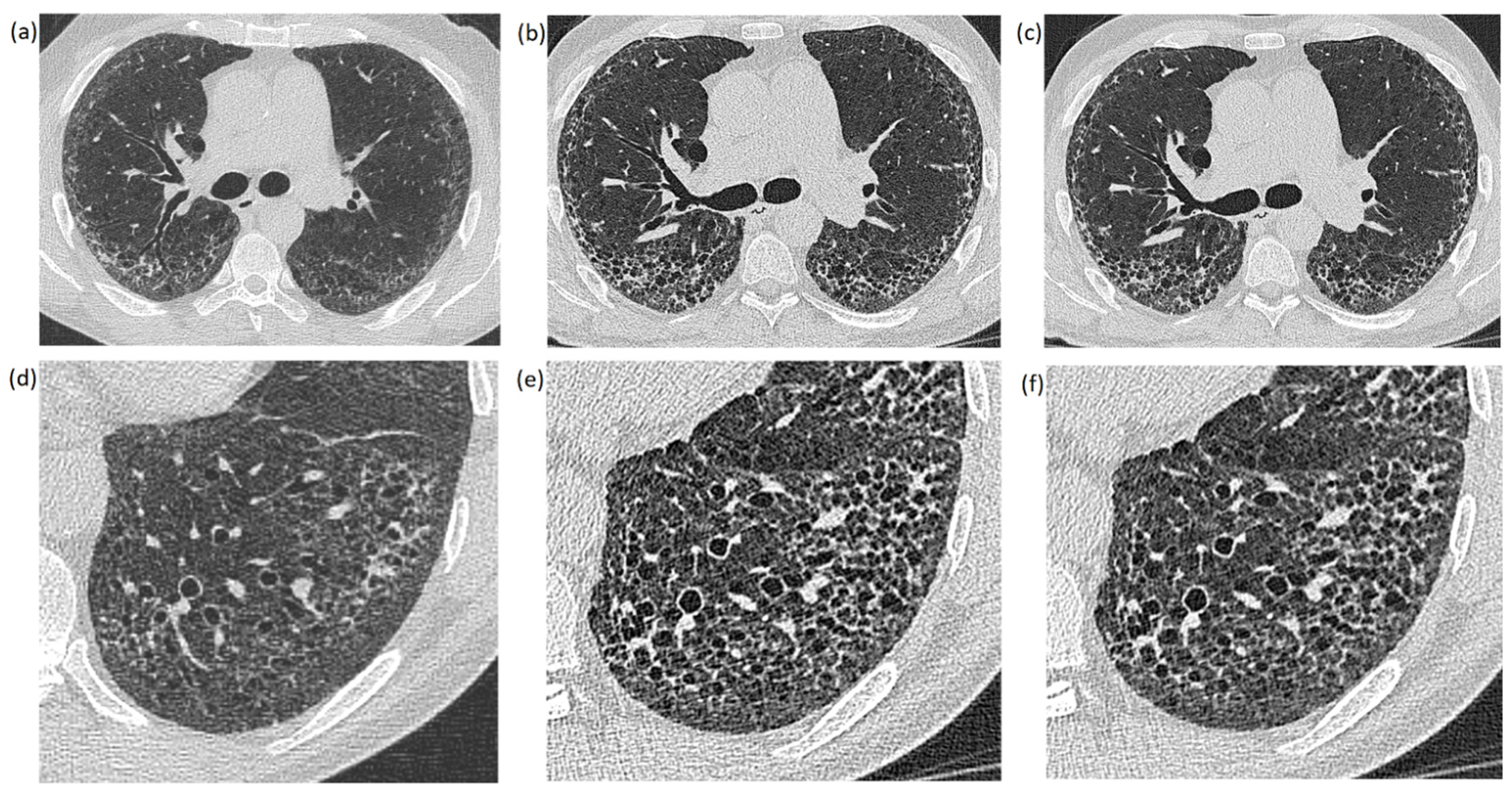 Diagnostics | Free Full-Text | Low-Dose High-Resolution