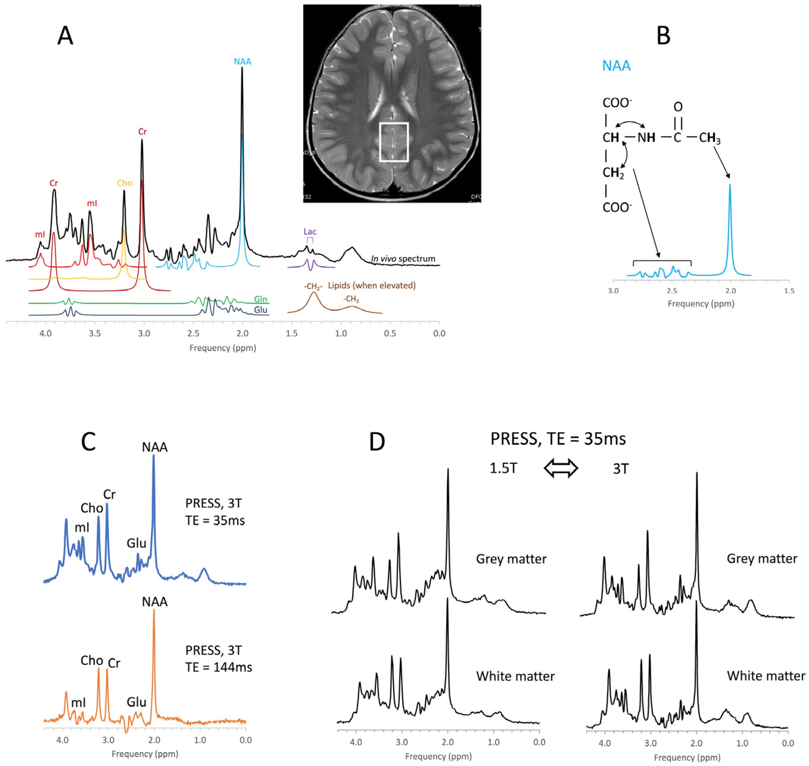 Diagnostics | Free Full-Text | Proton MR Spectroscopy of Pediatric Brain  Disorders