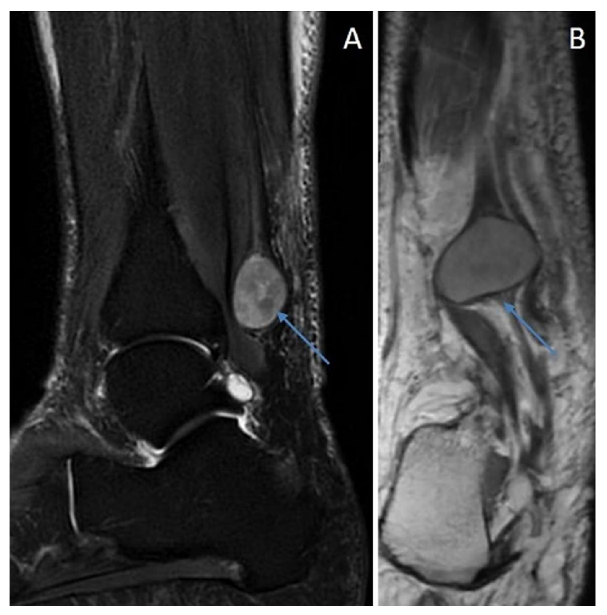 Diagnostics 12 01463 g010