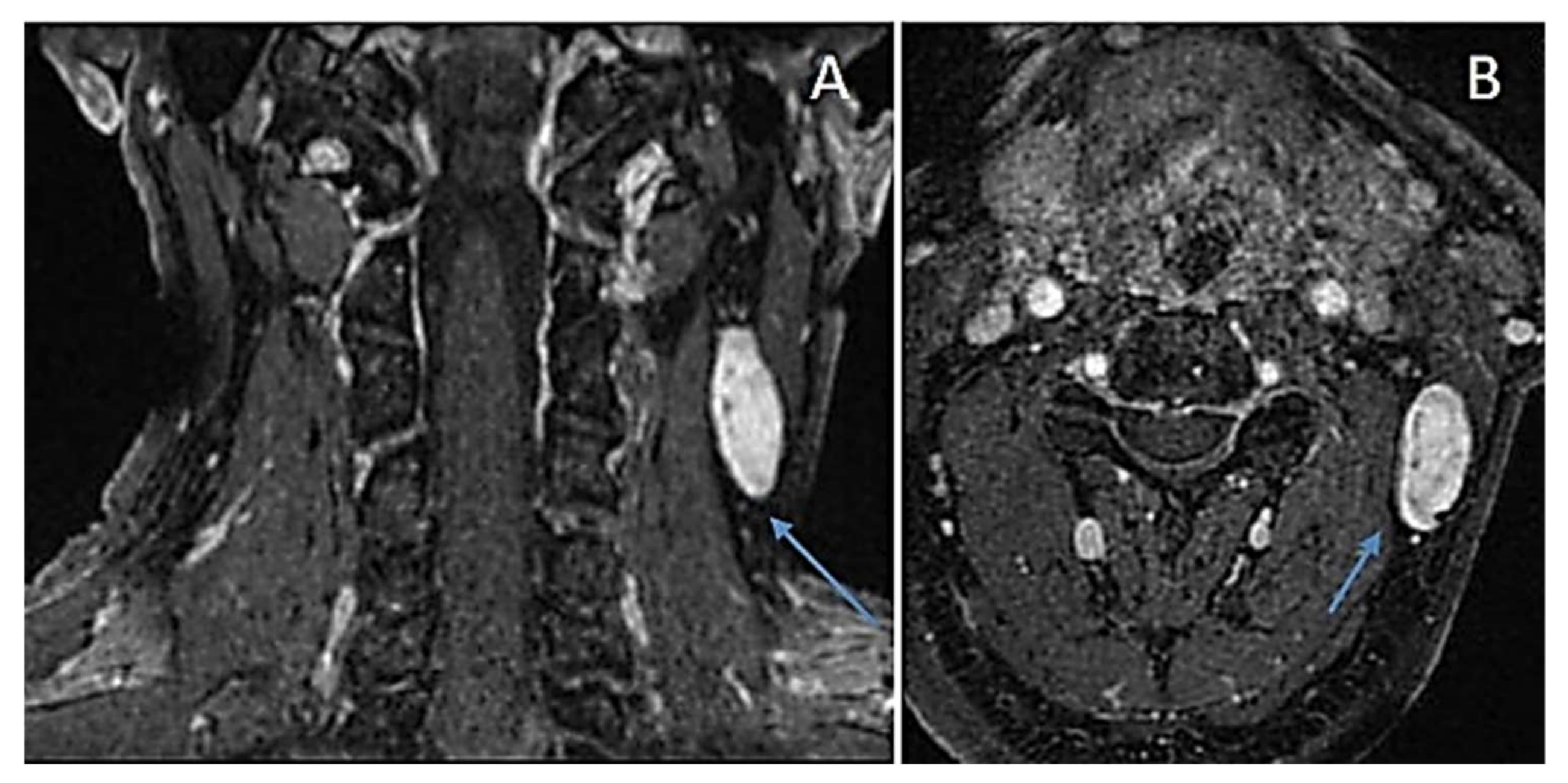 Diagnostics 12 01463 g011